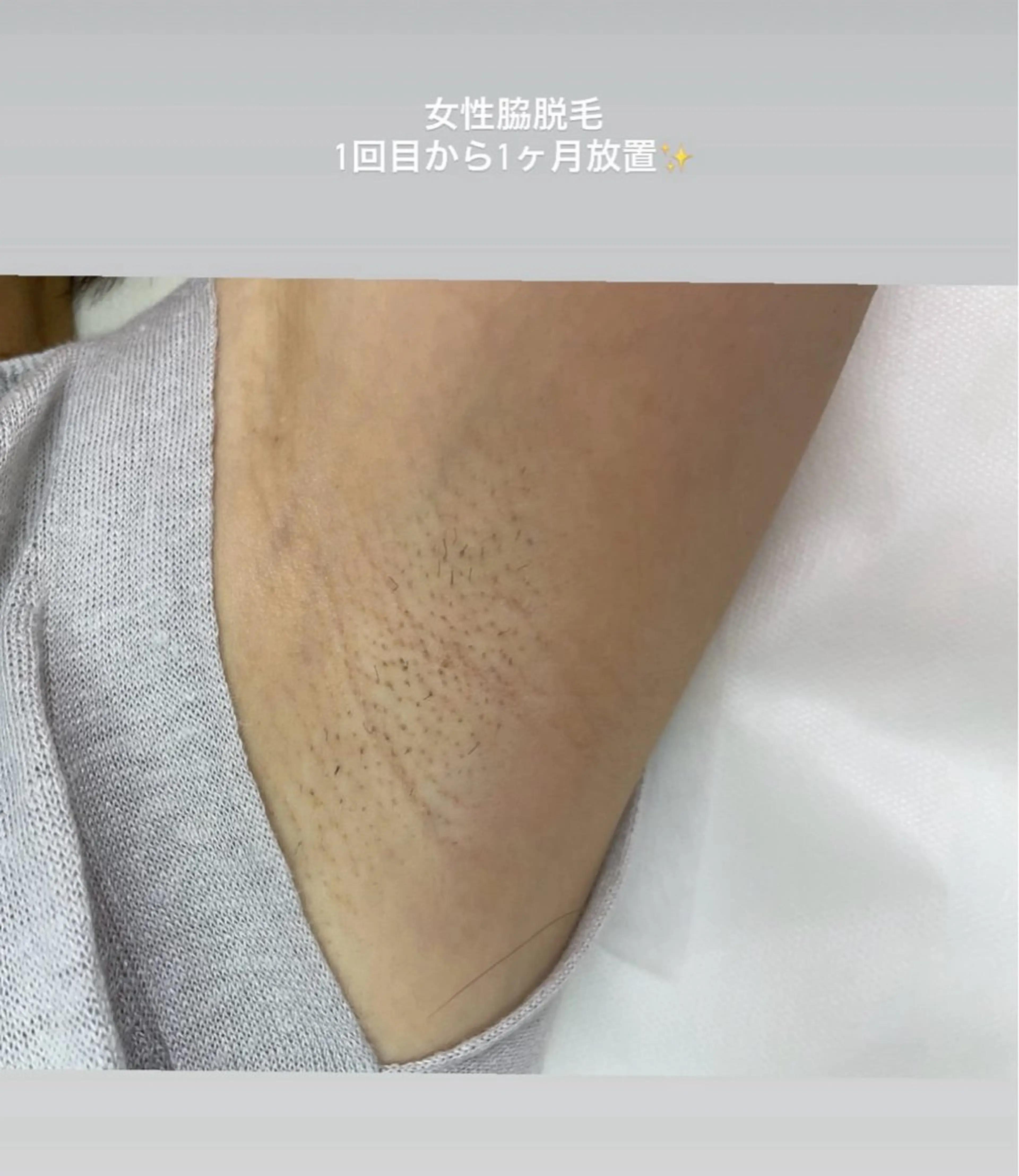 脱毛 🤍SÉALIE⟡. ｼｱﾘｰ脱毛サロンのエステ・リラクイメージ