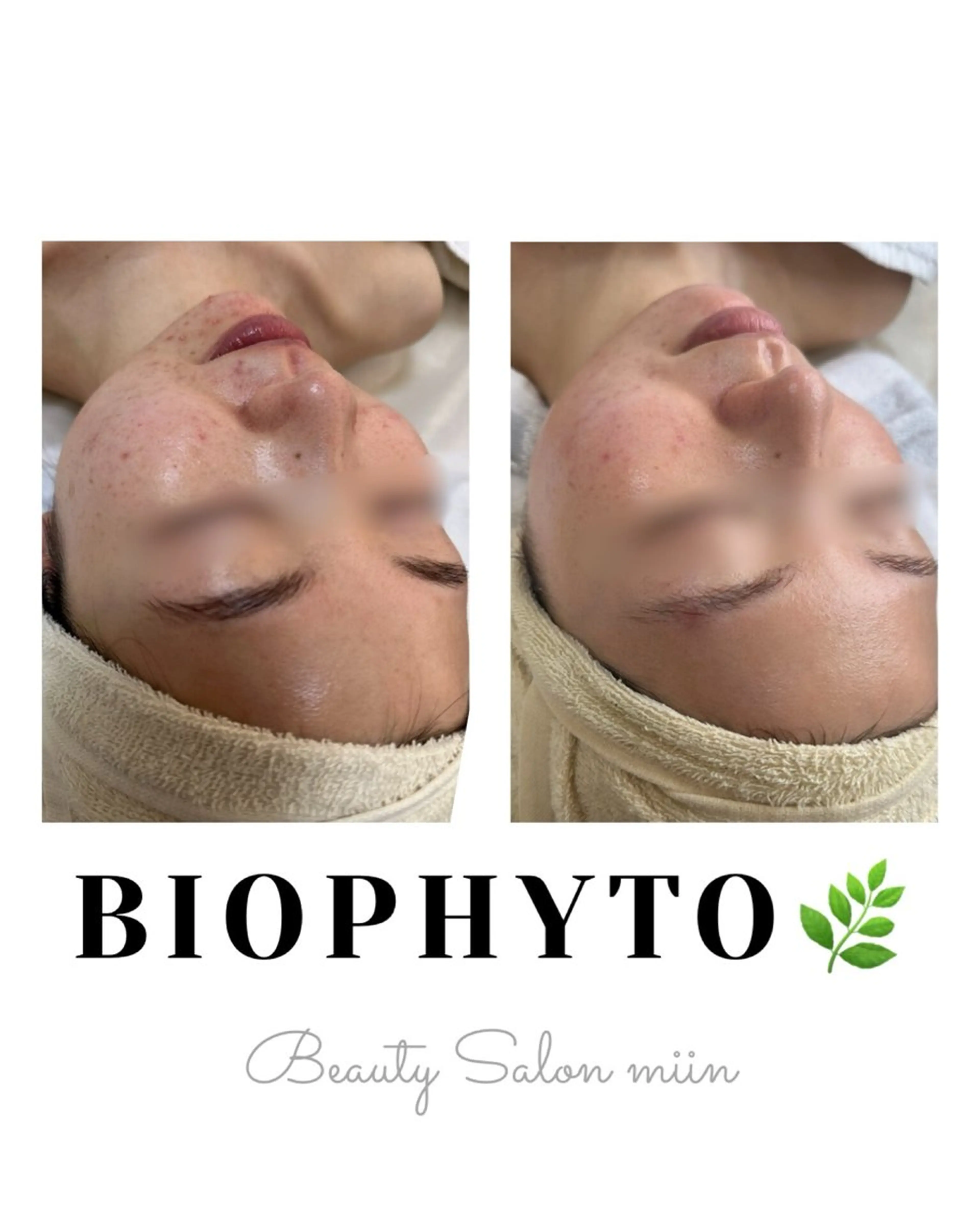 リラク 韓国肌管理 白玉肌管理®︎のエステ・リラクイメージ