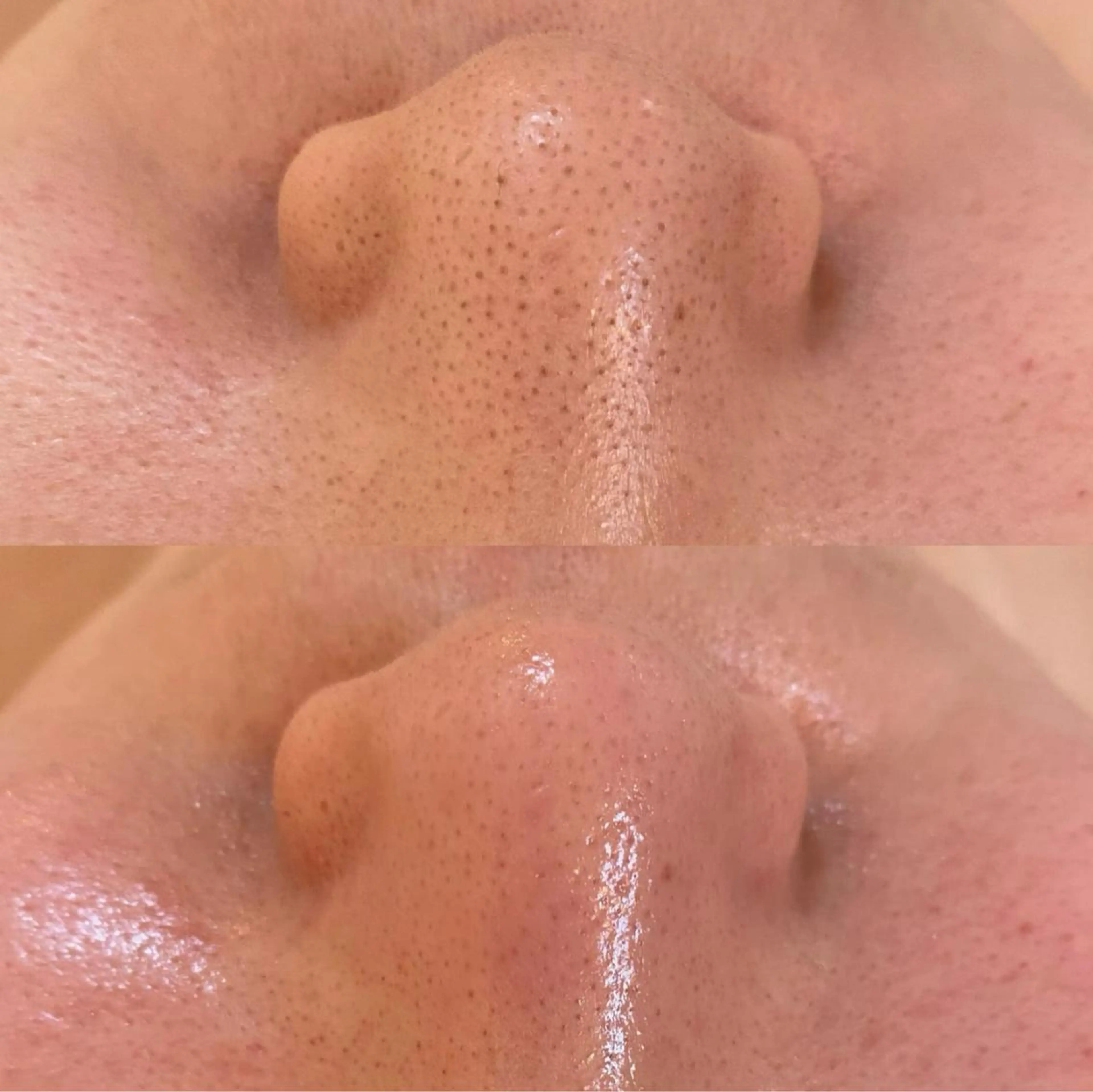 エステ リラク BELCIA福岡店 レコルトデベルシアのエステ・リラクイメージ