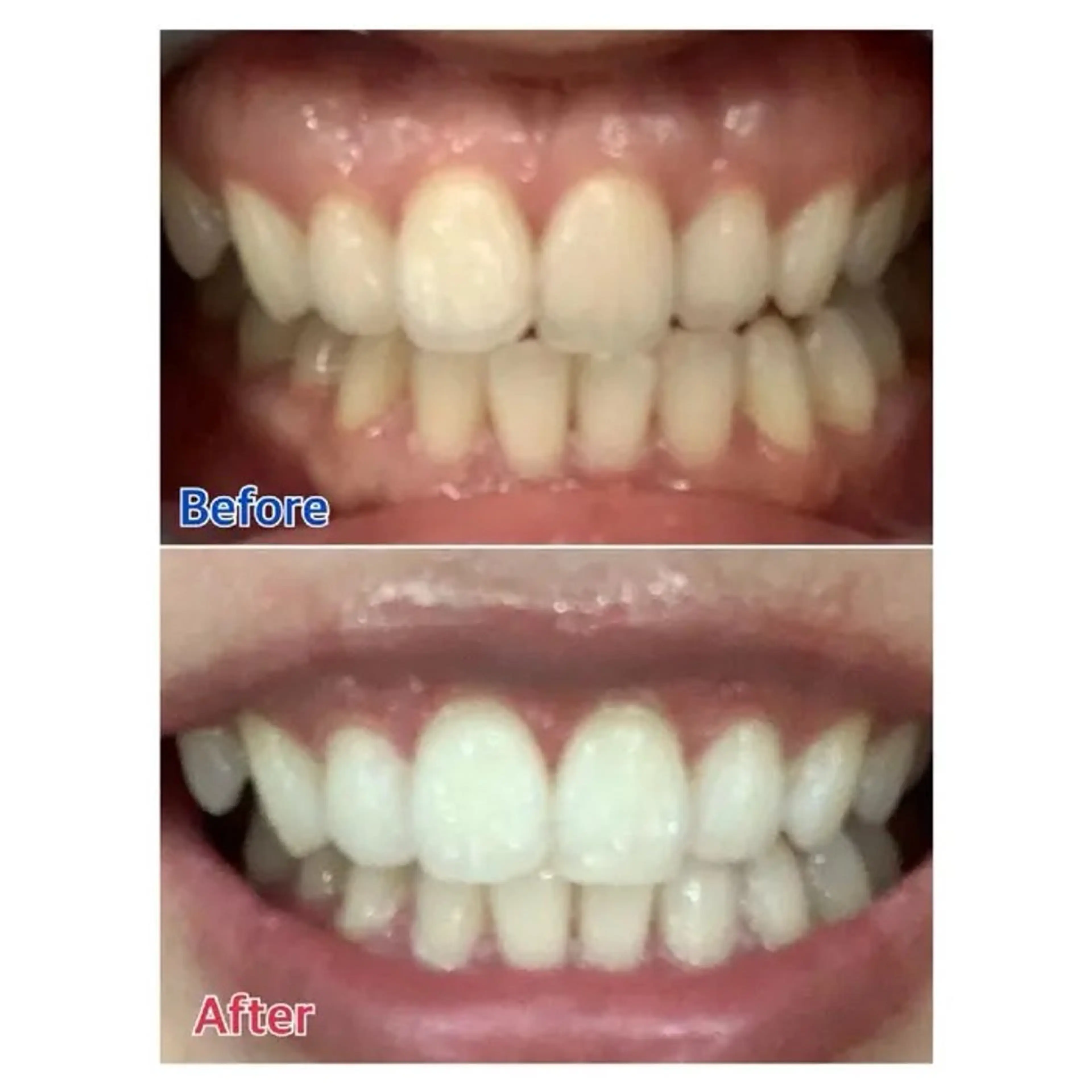 M渋谷 ホワイトニングのエステ・リラクイメージ