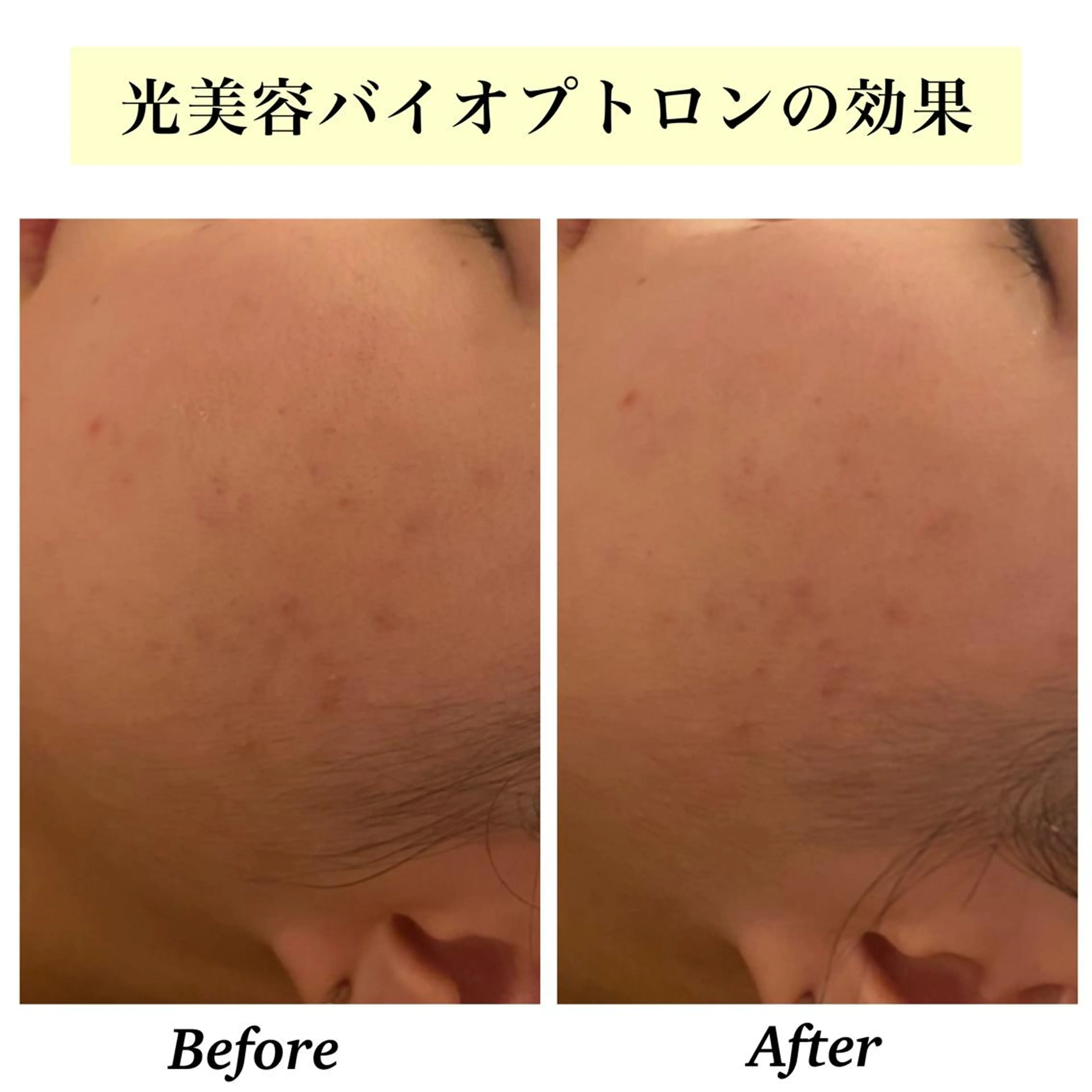 エステ リラク Bellesthe （ベルエステ）のエステ・リラクイメージ