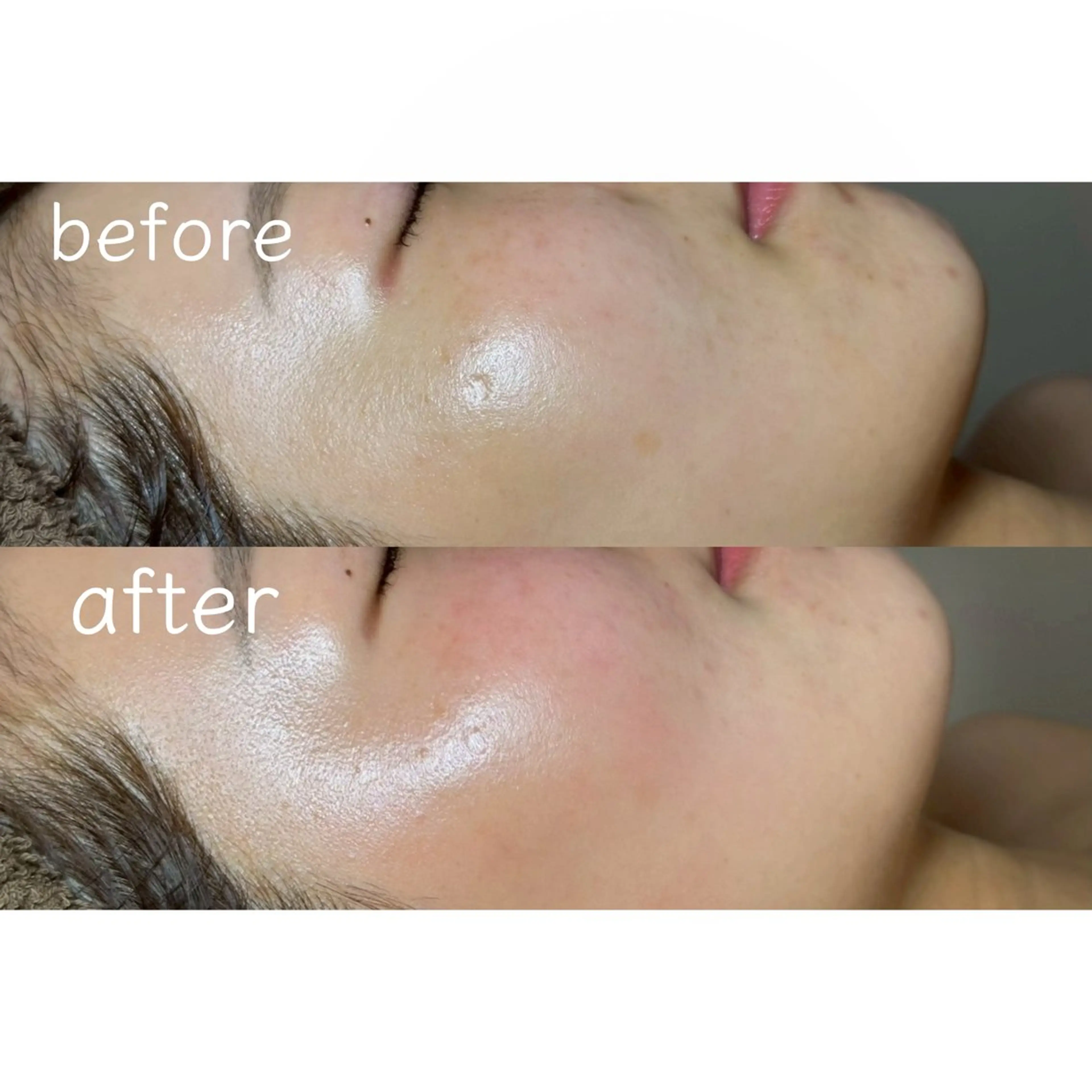 エステ 長野 美里のエステ・リラクイメージ