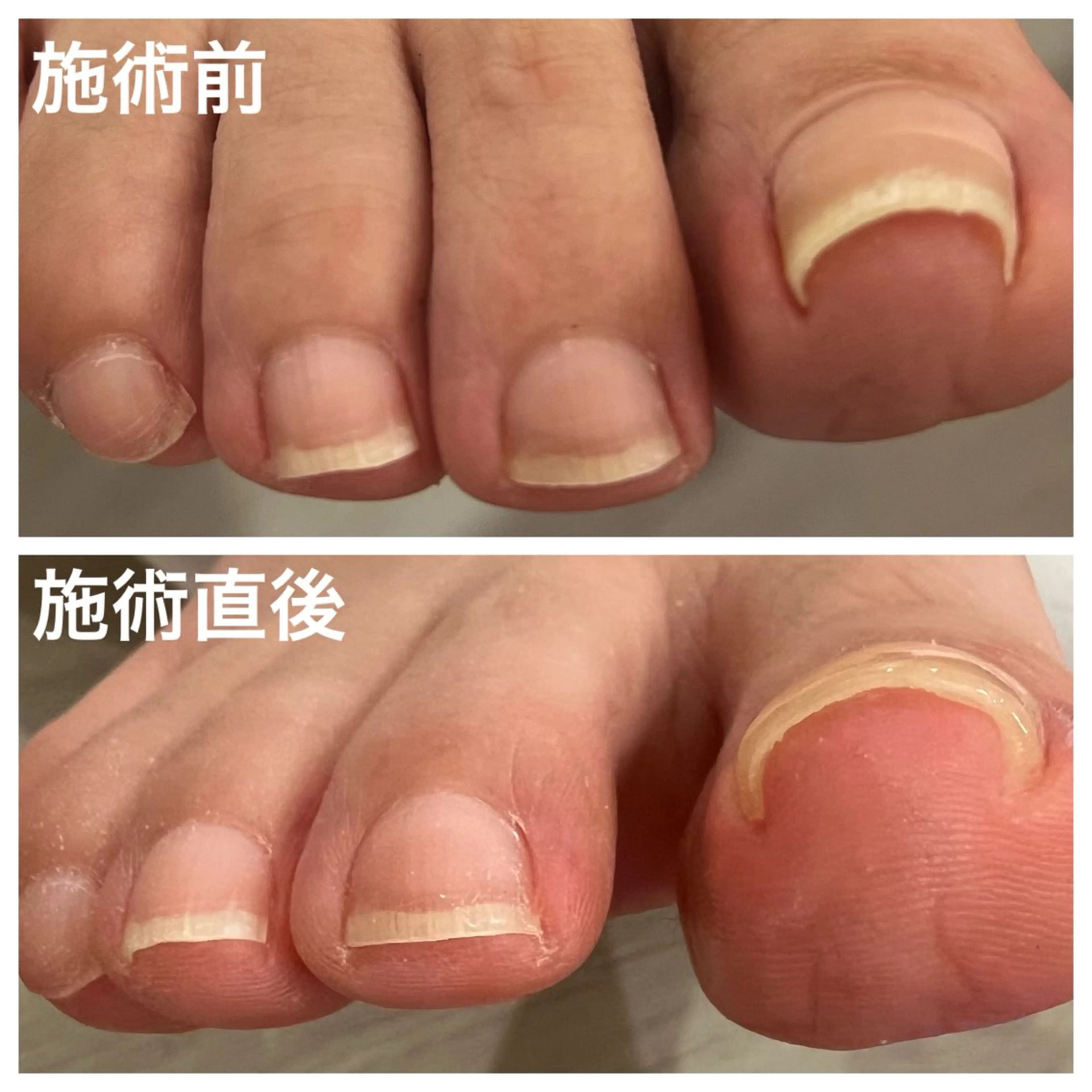 ネイル S Mihoのネイルデザイン