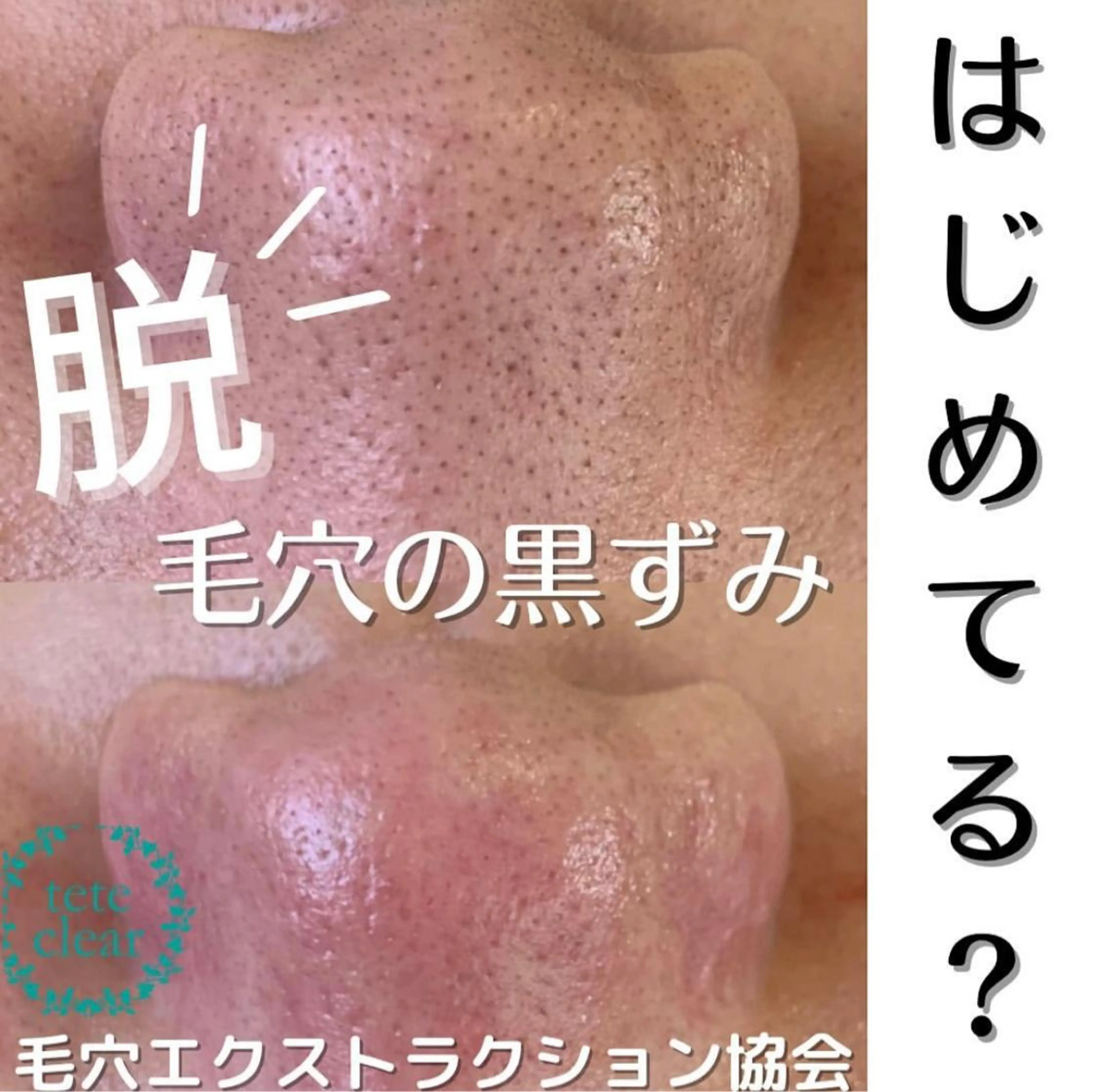 毛穴/シミ肝斑/脱毛 横山梨里のエステ・リラクイメージ