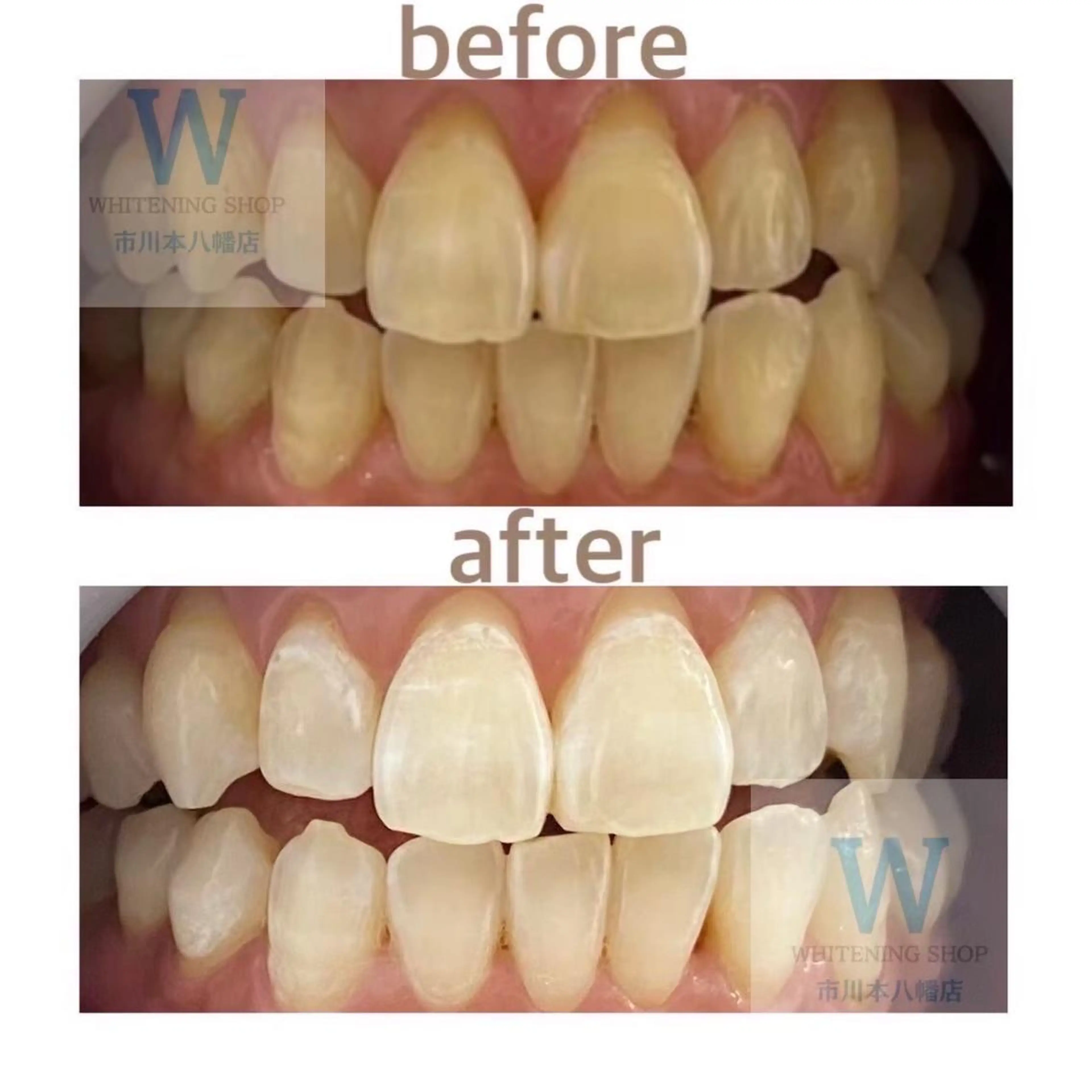 ホワイトニング ショップ本八幡店のエステ・リラクイメージ