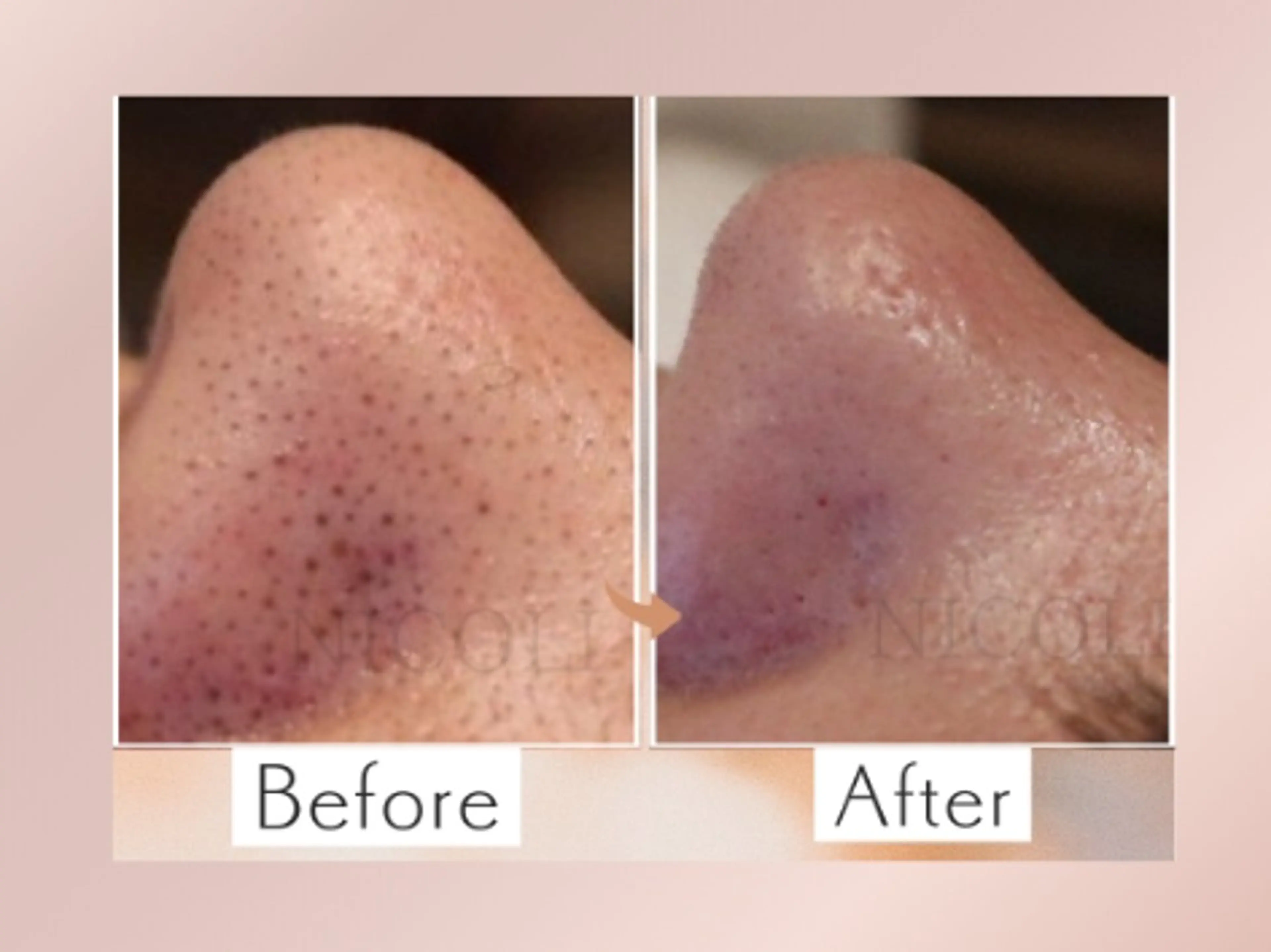 エステサロン NICOLIのエステ・リラクイメージ