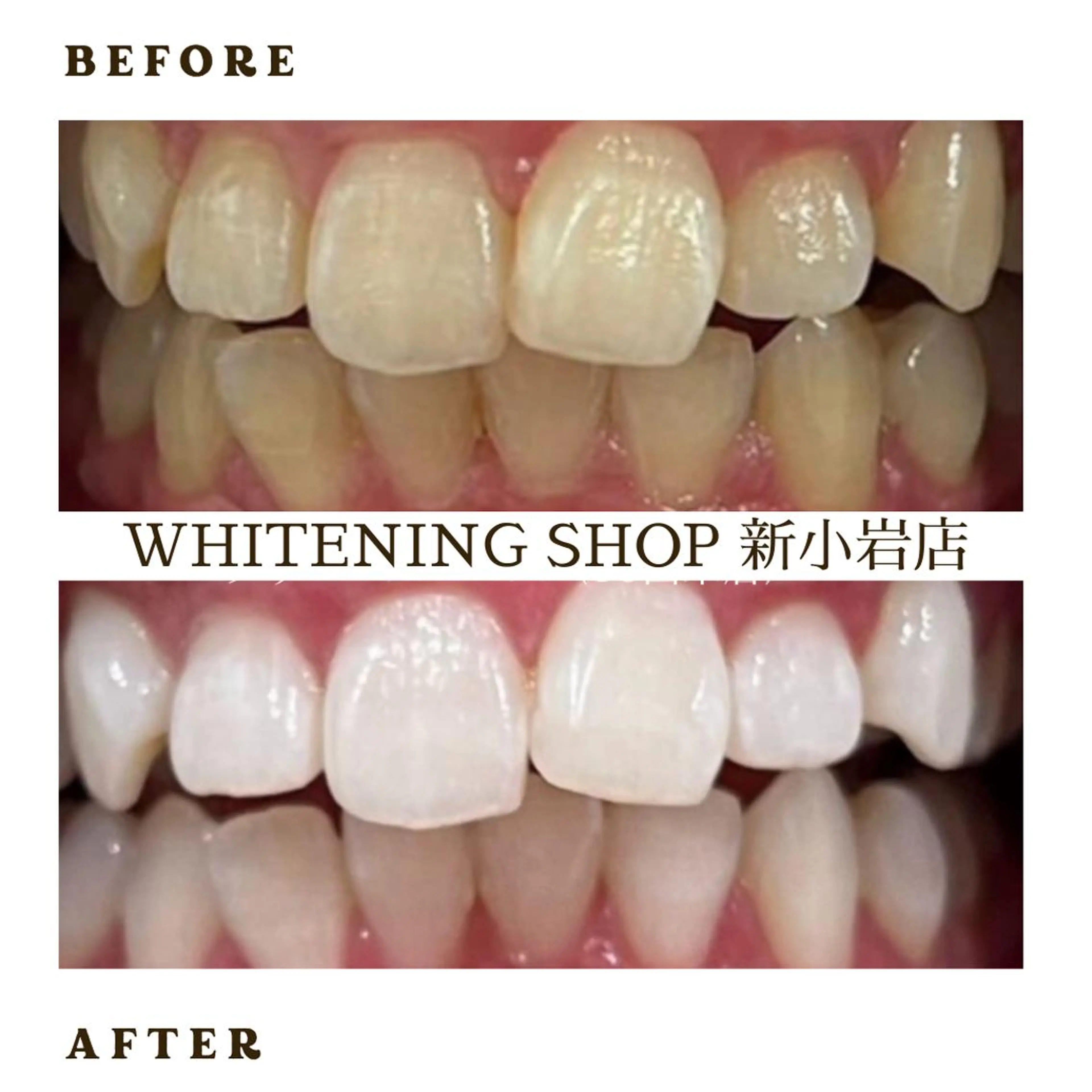 メンズ その他 ホワイトニング ショップ新小岩店のその他イメージ