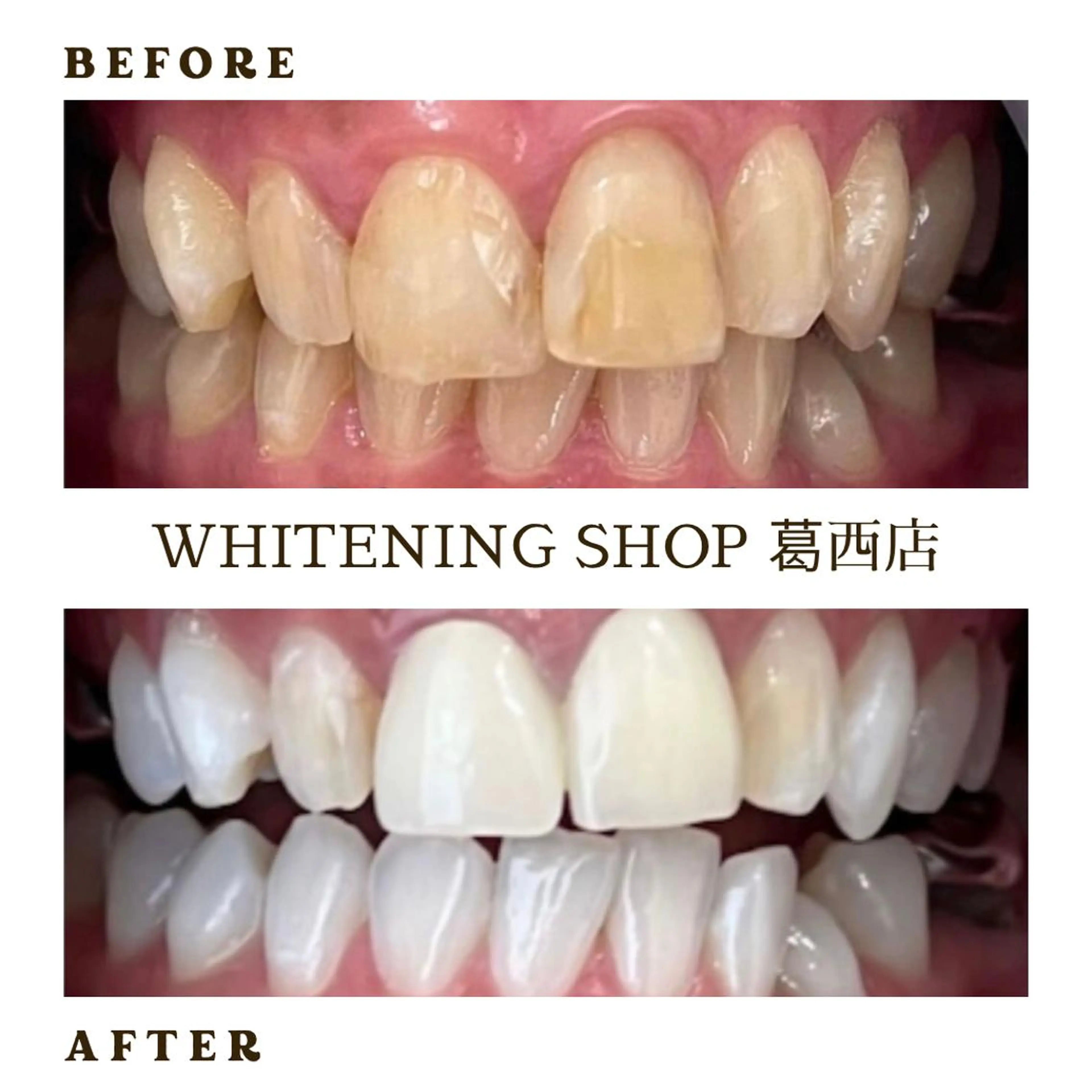 メンズ その他 ホワイトニング ショップ葛西店のその他イメージ