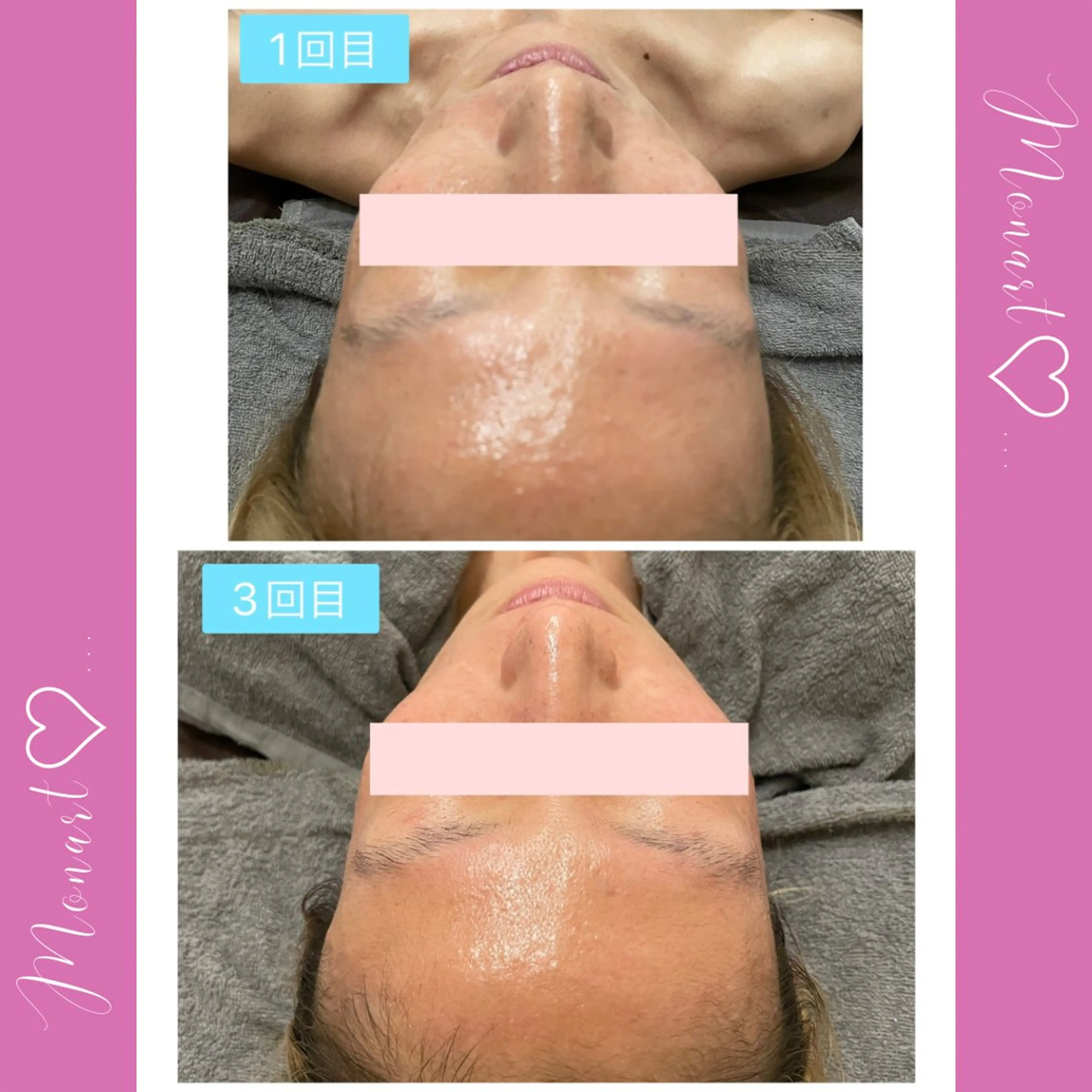 Monart -deux-のエステ・リラクイメージ