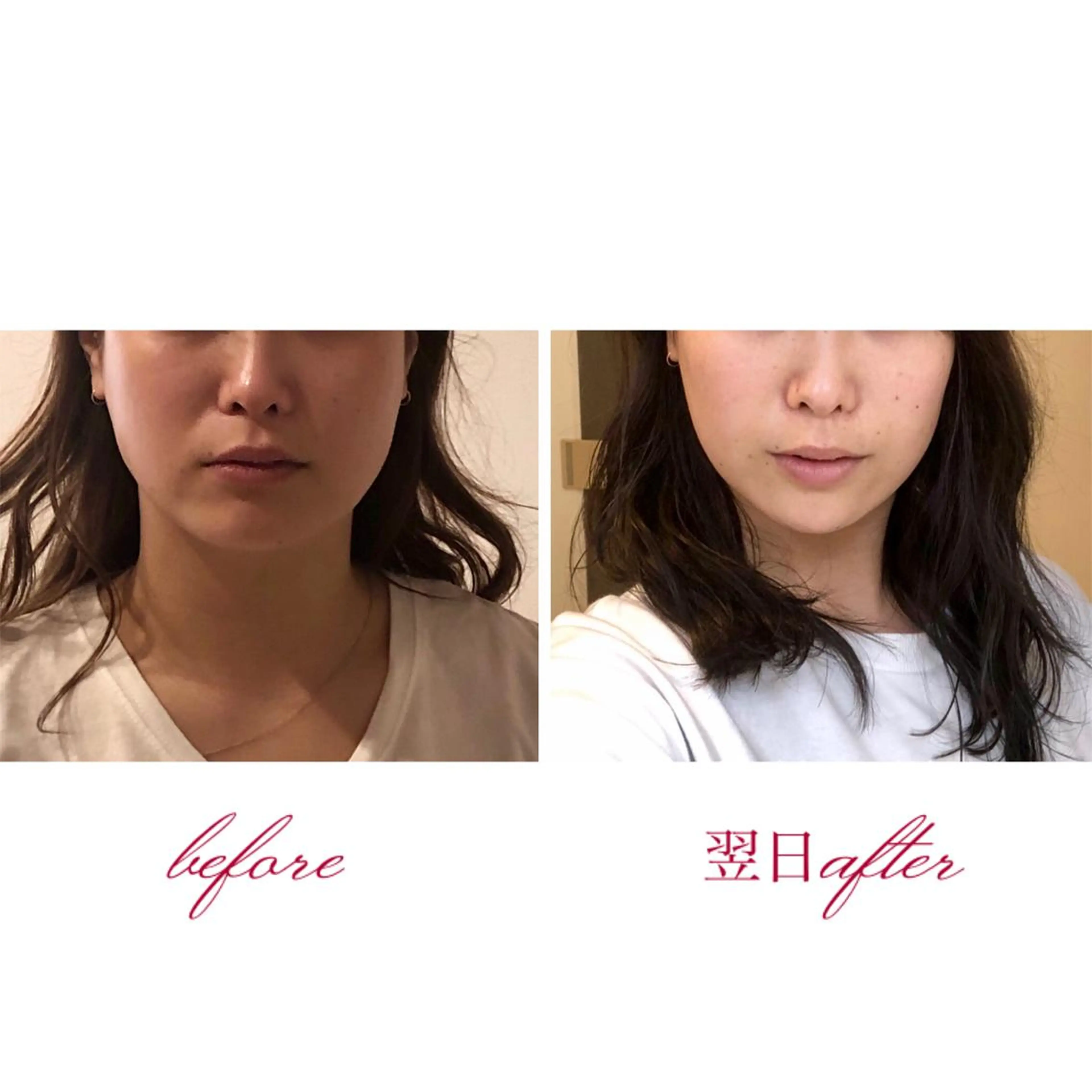 《👑当サロン人気No.1》結果を早く出したい方へ✨むくみ改善小顔矯正＋頭蓋骨調整ヘッドスパ（50分）の写真