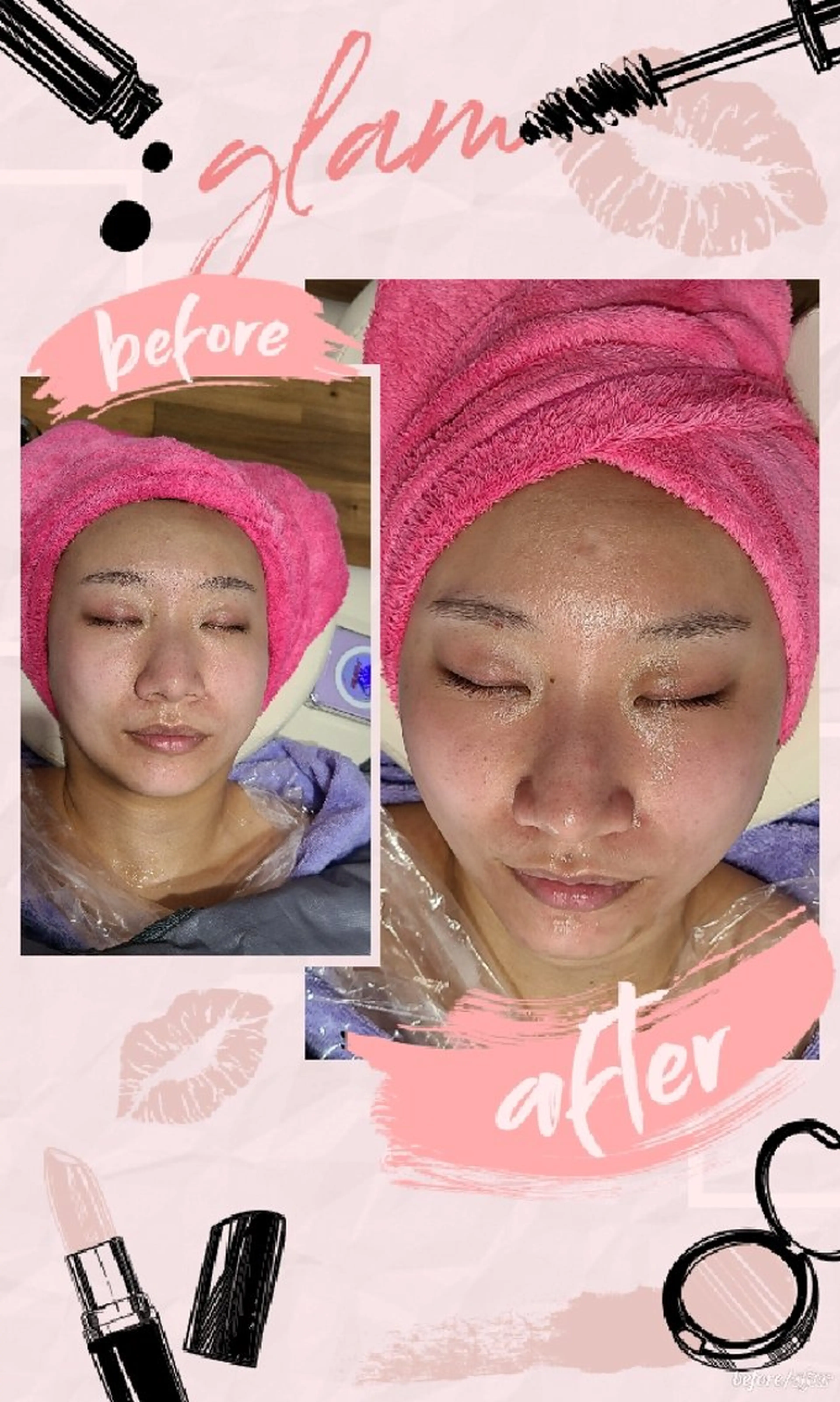 角栓取り専門エステ ベテラン講師幸田のエステ・リラクイメージ