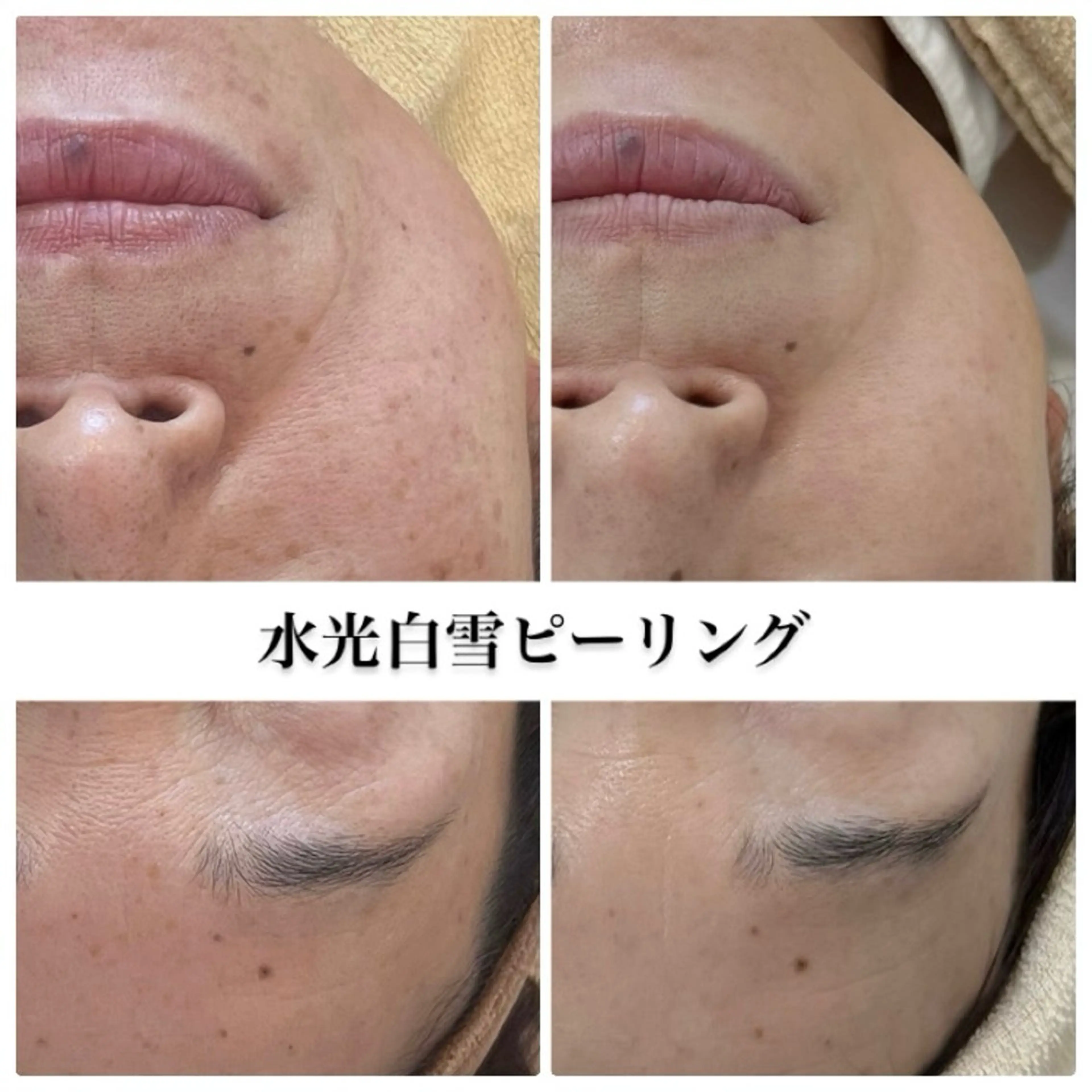 肌質管理専門店 Lé pia　AMIのエステ・リラクイメージ