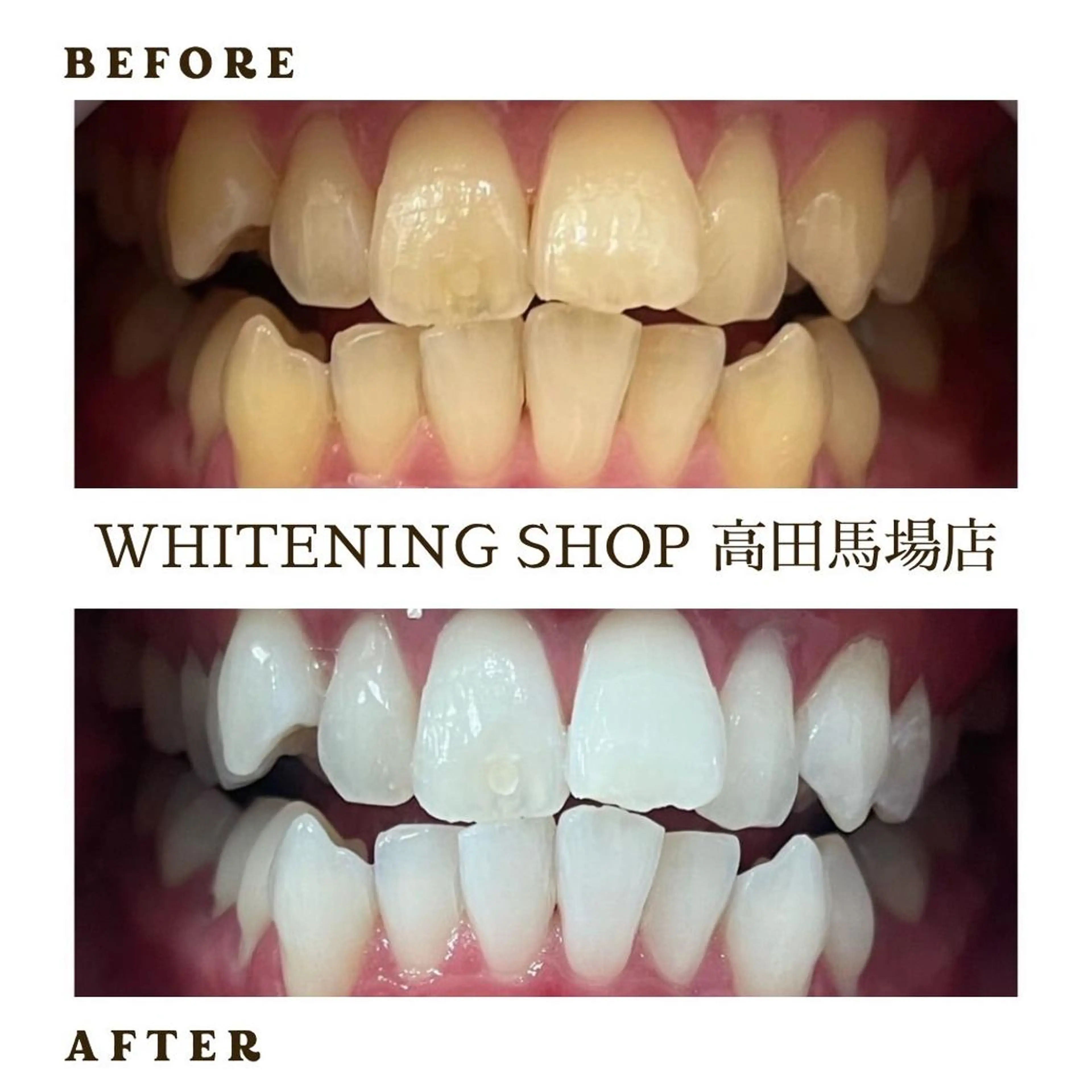 メンズ その他 ホワイトニング ショップ高田馬場店のその他イメージ