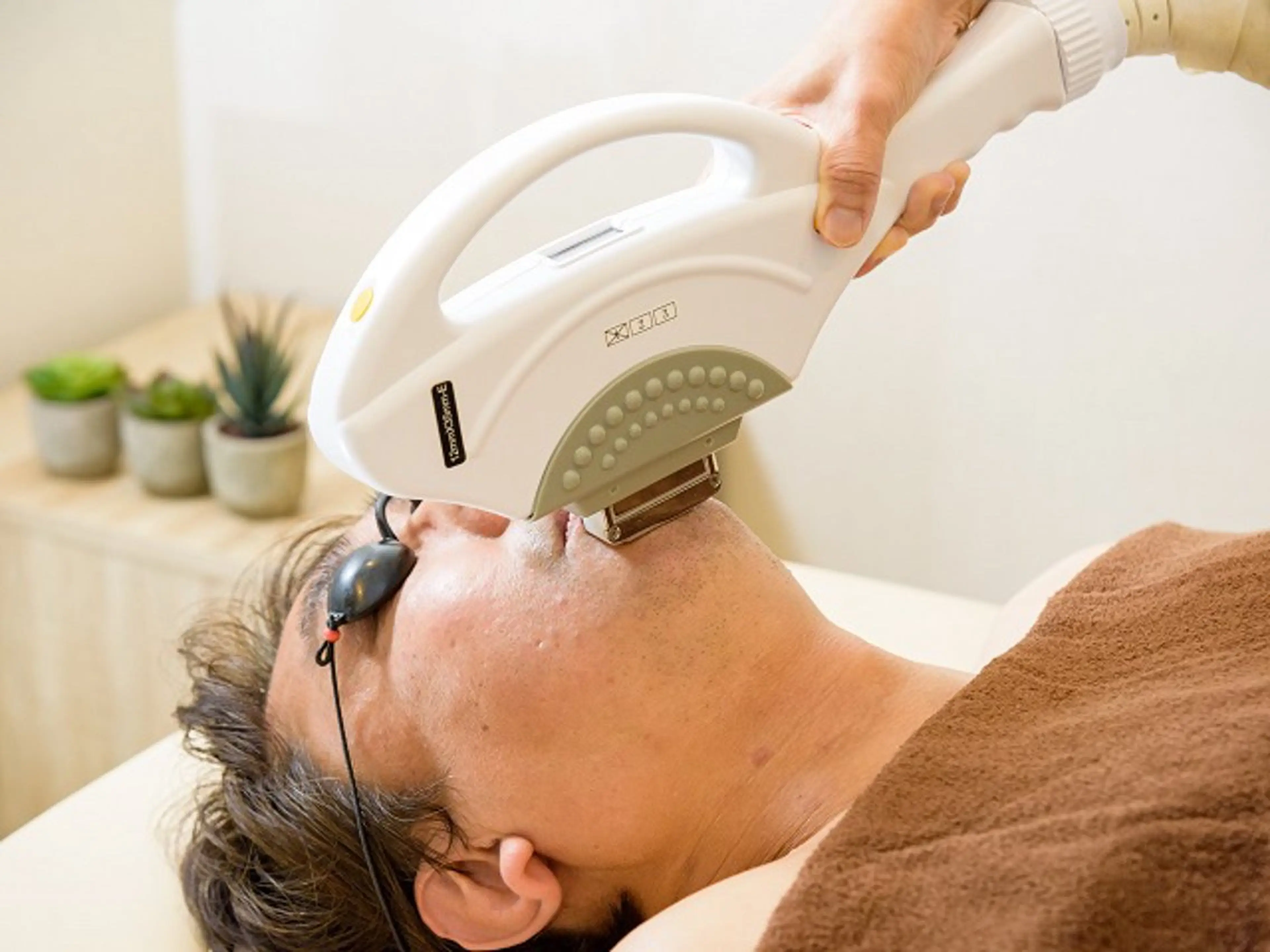 【男性：完全都度払い】まるごとヒゲ脱毛1回4000円の写真