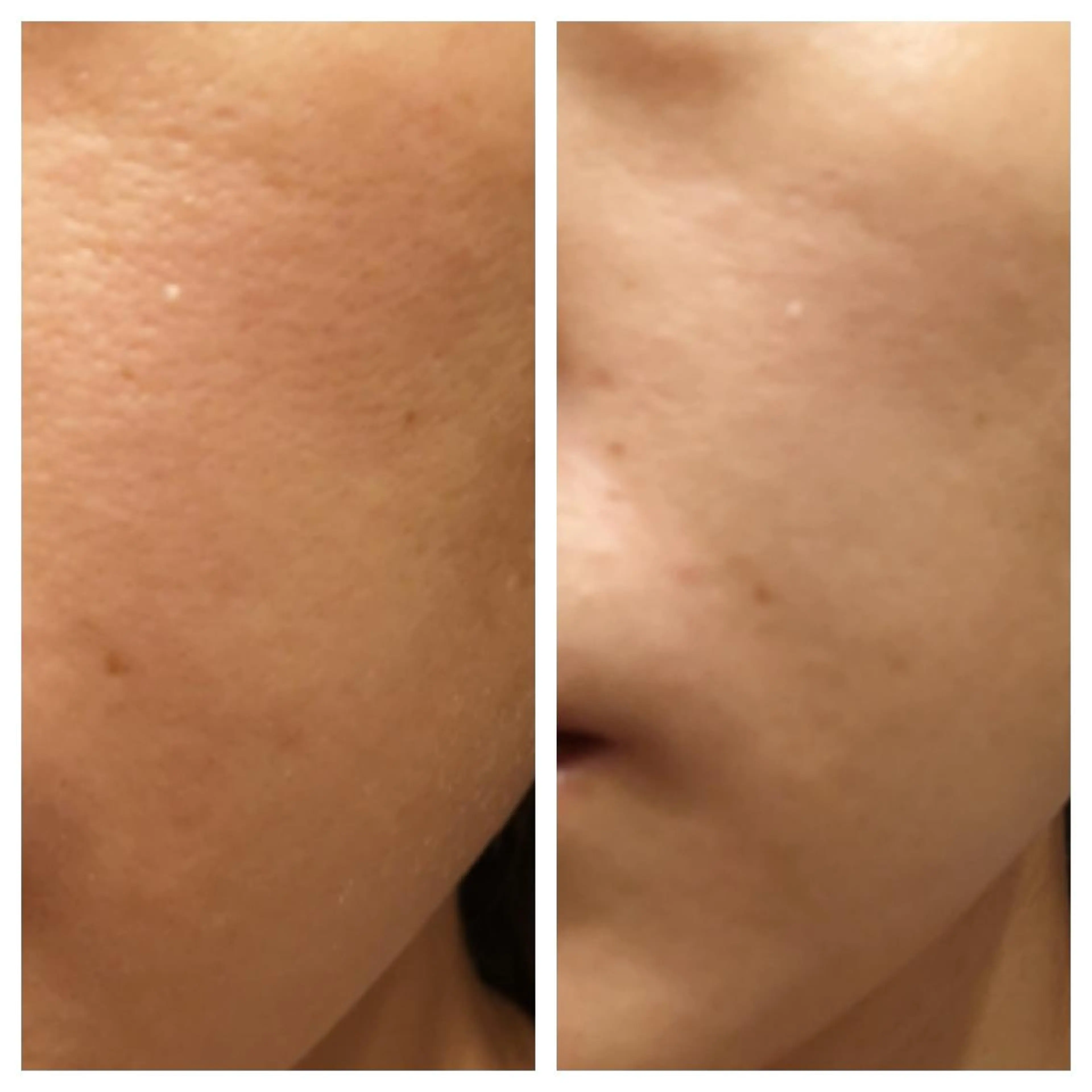 🅖🅤🅩🅔🅛 salonのエステ・リラクイメージ