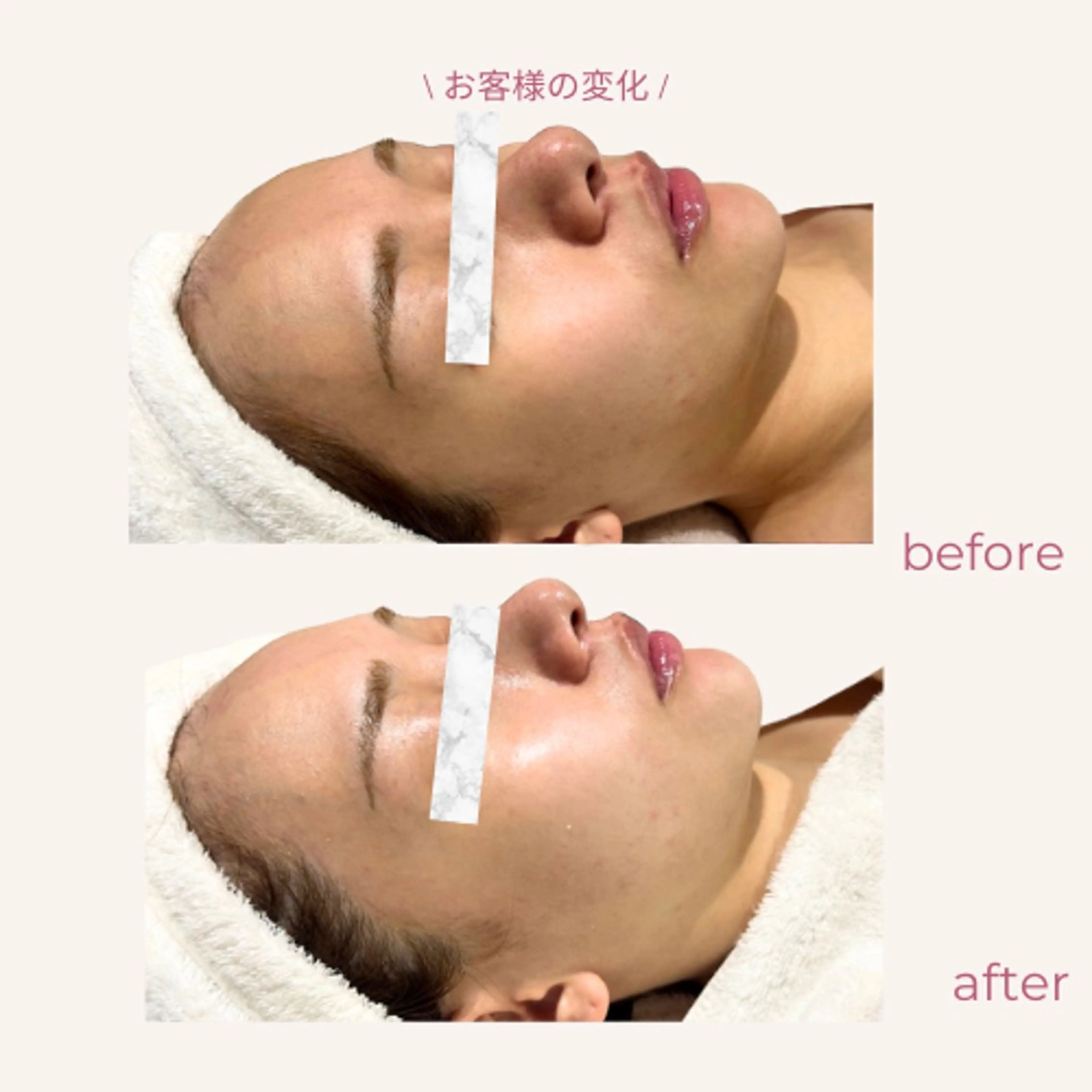 エステ aimer服部 /  小顔 ・ 痩身のその他イメージ