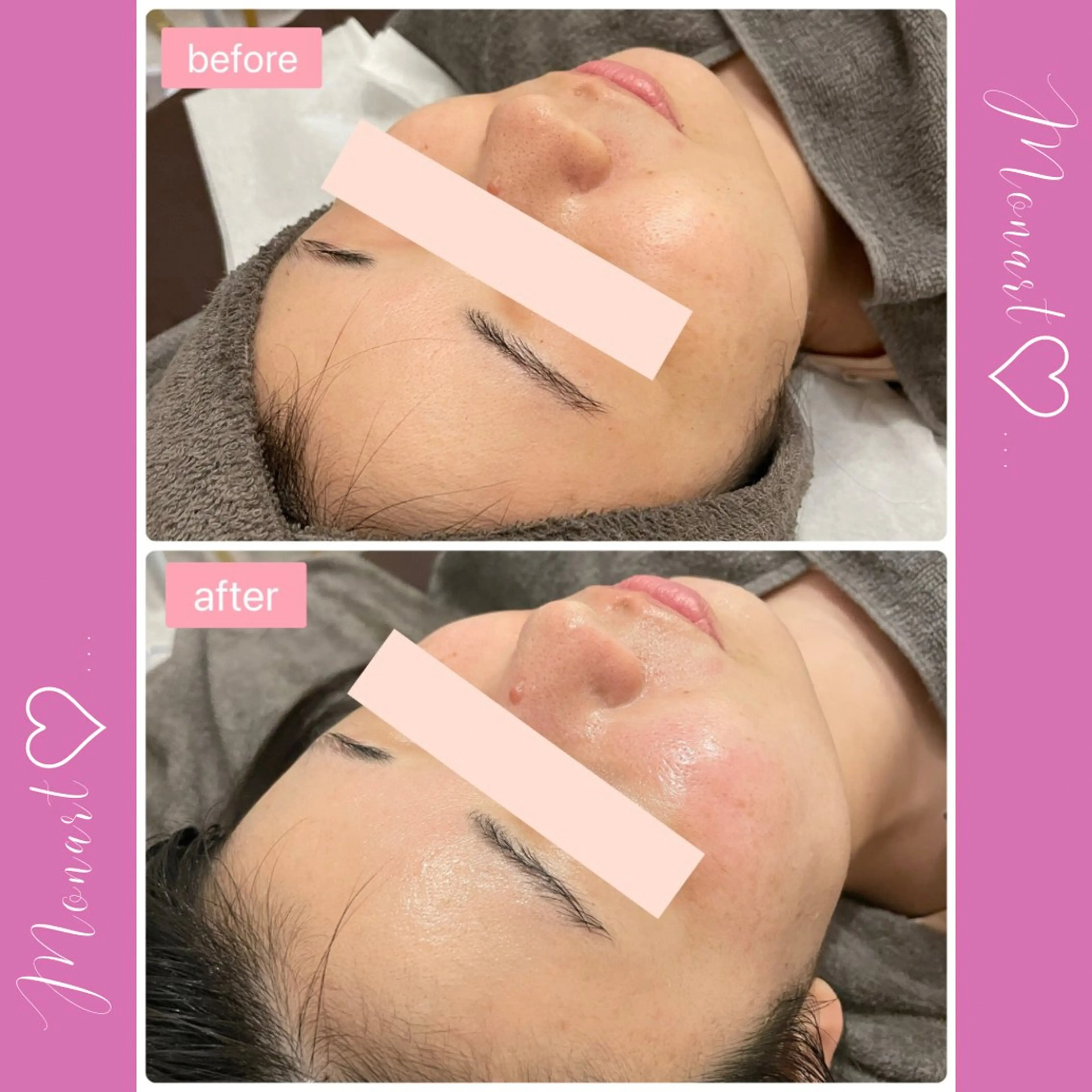 Monart -deux-のエステ・リラクイメージ