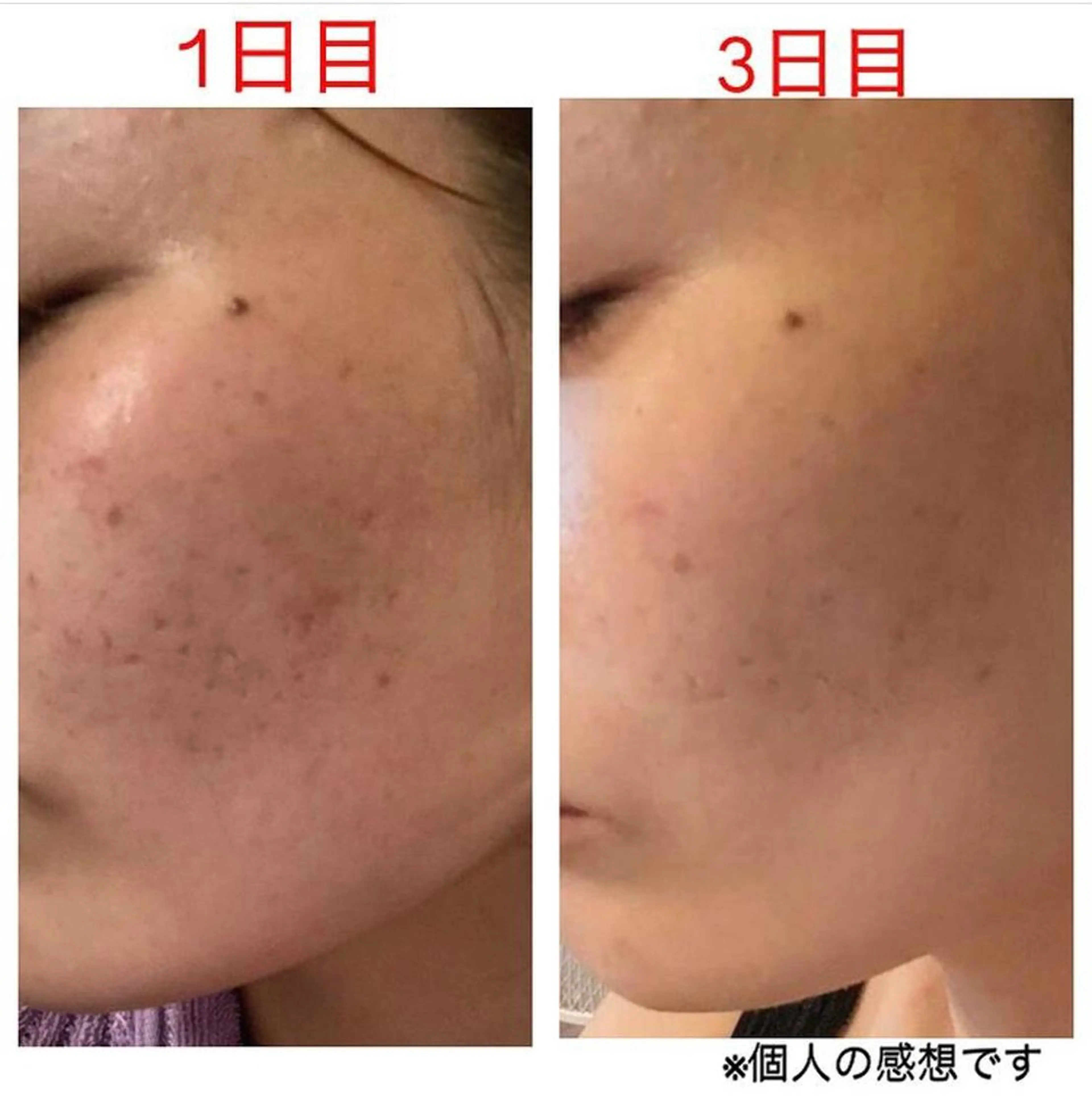 tominaga ryokoのヘアスタイル