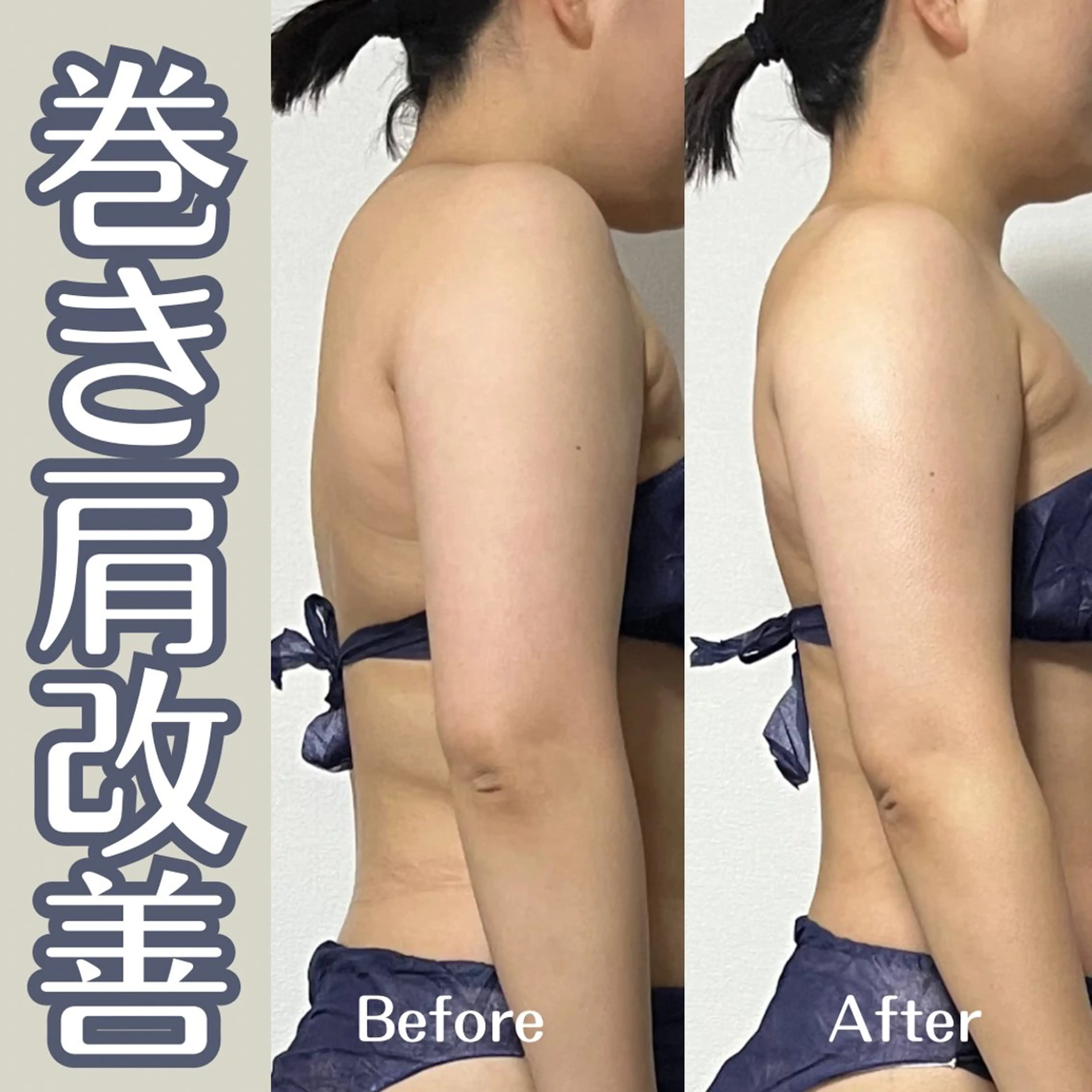 エステ リラク 小顔矯正/骨格矯正 AKANEのエステ・リラクイメージ