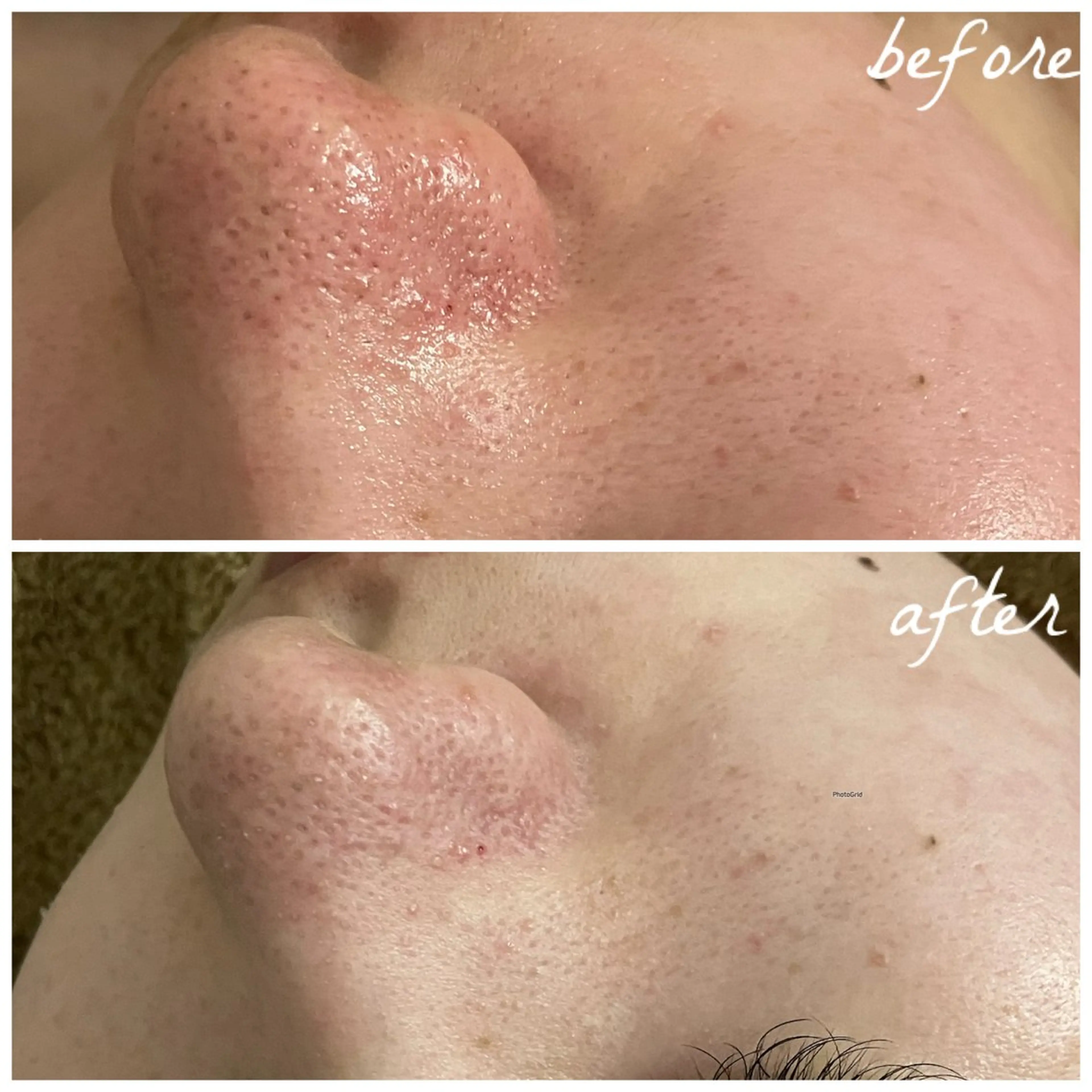 メンズ エステ メナード岐阜市茜部 杉浦のエステ・リラクイメージ