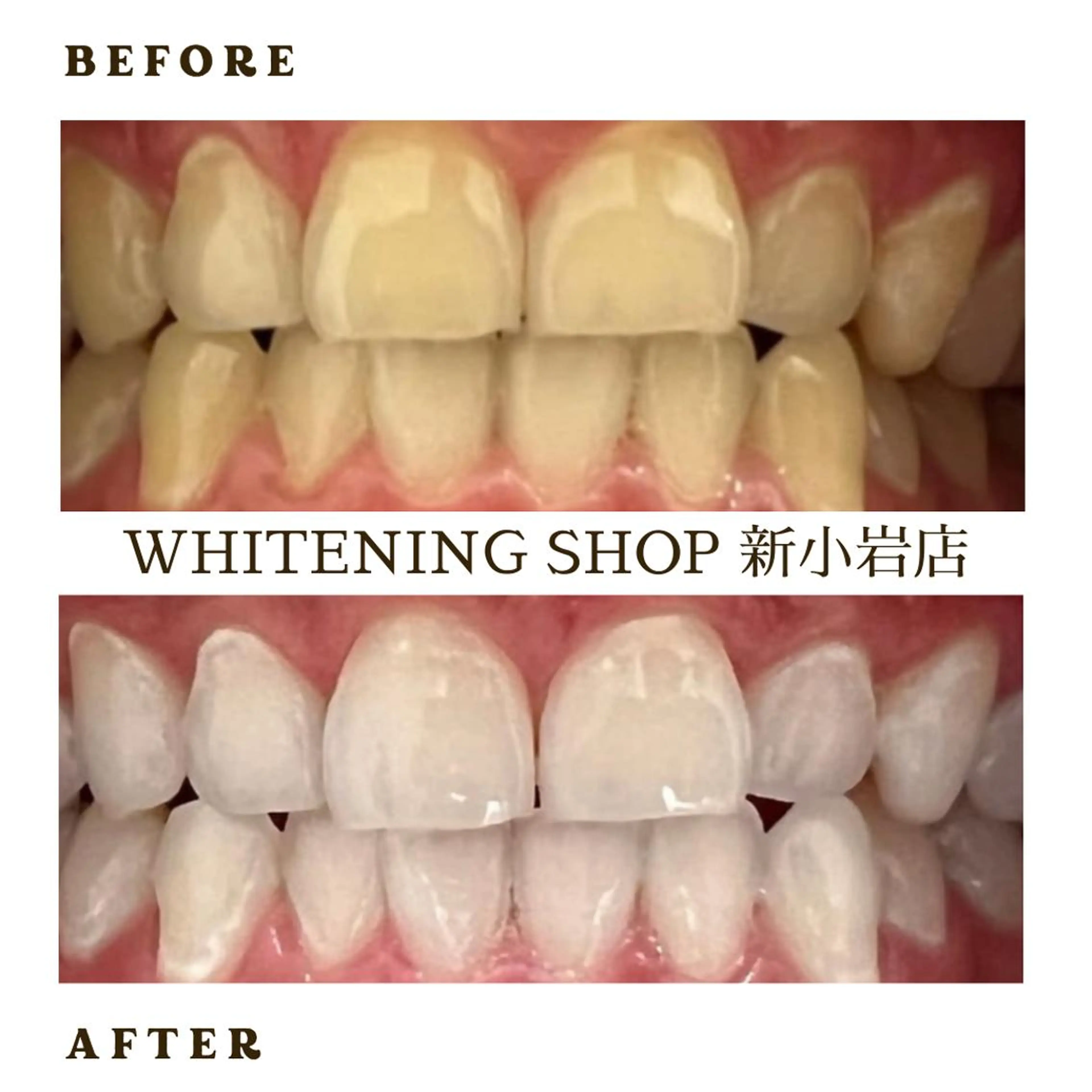 メンズ その他 ホワイトニング ショップ新小岩店のその他イメージ