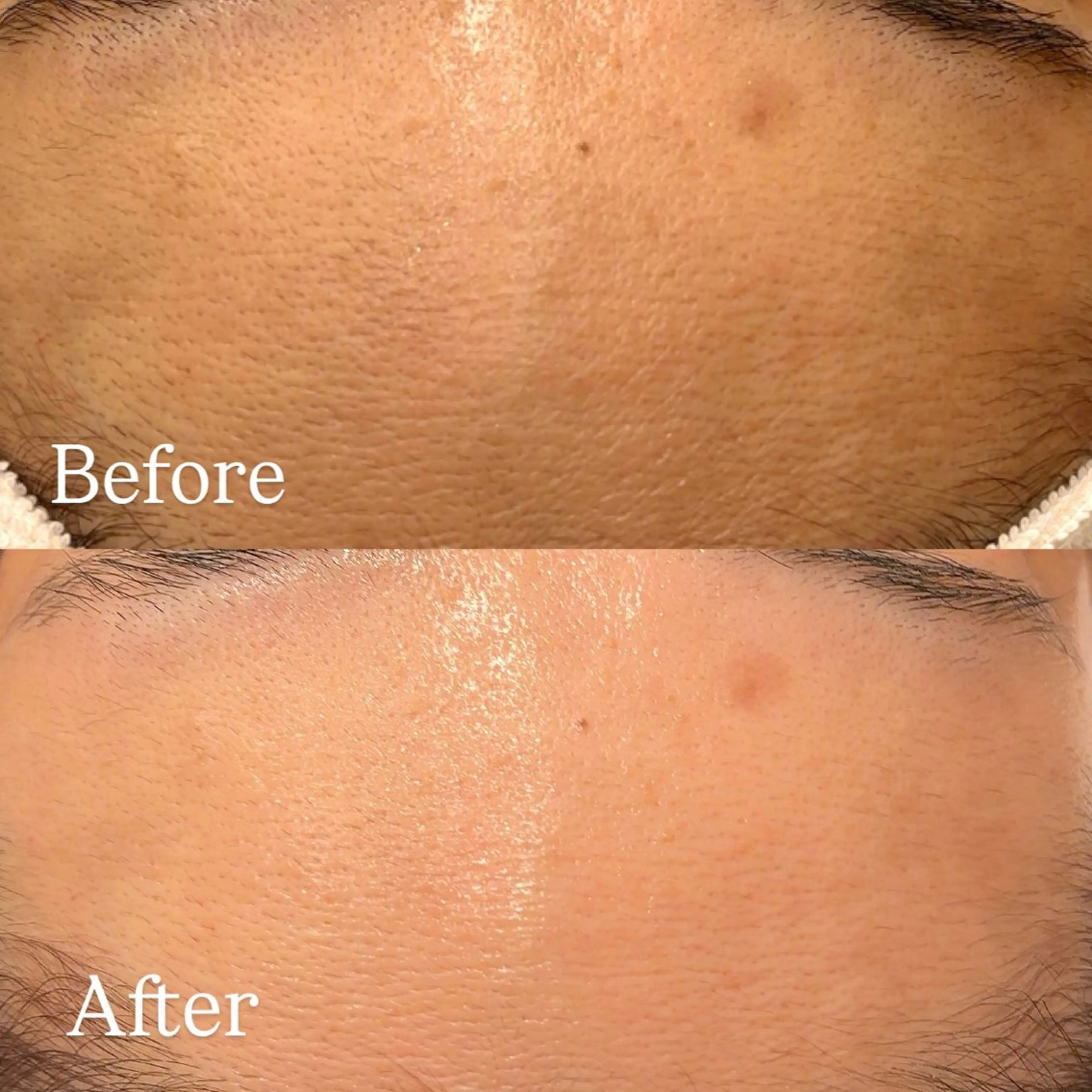 Hari Lounge恵比寿所属・chika🦋 ハリラウンジ恵比寿のエステ・リラクイメージ