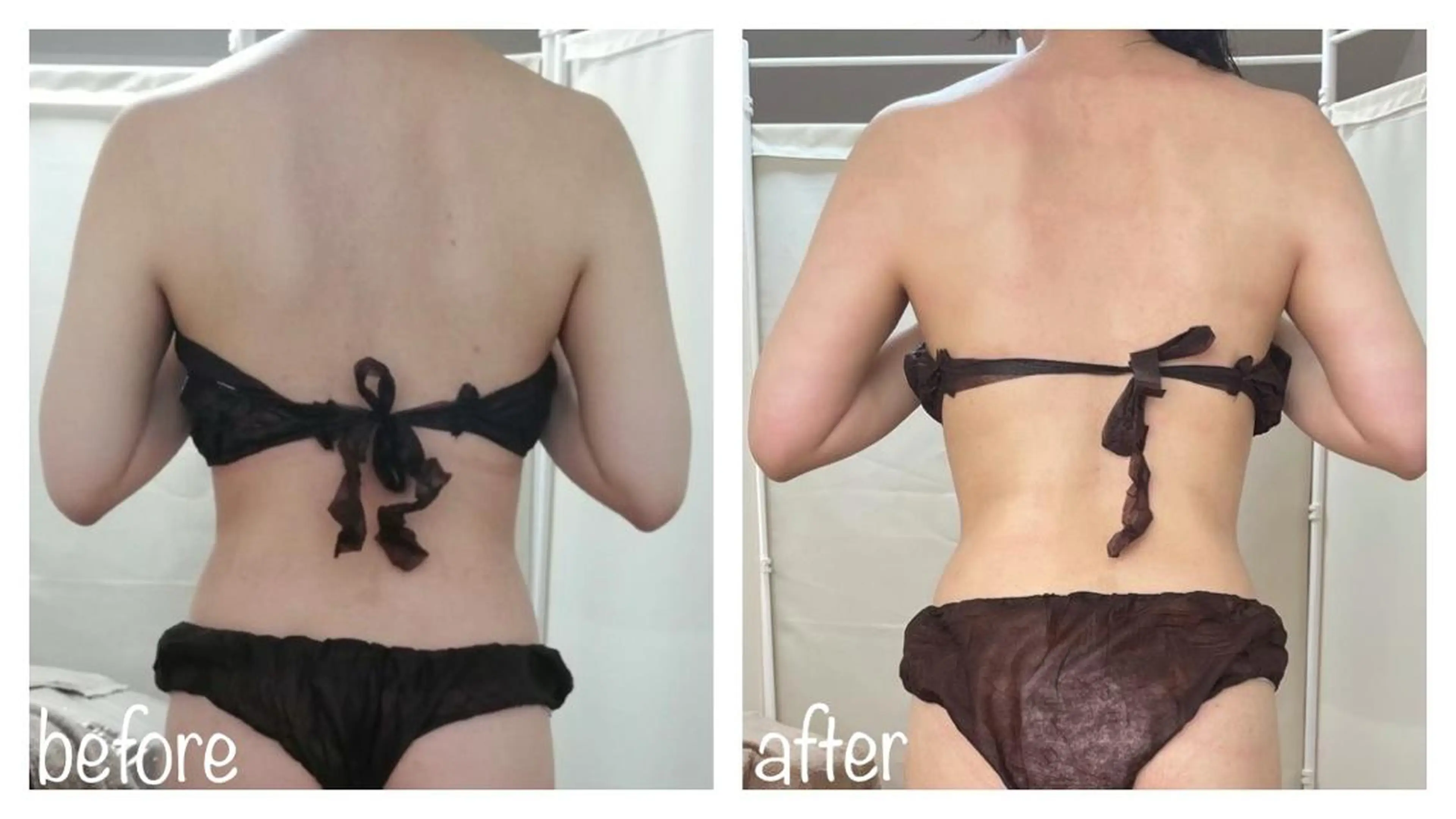 《本気痩せ×疲労改善 》  BILOOPのエステ・リラクイメージ