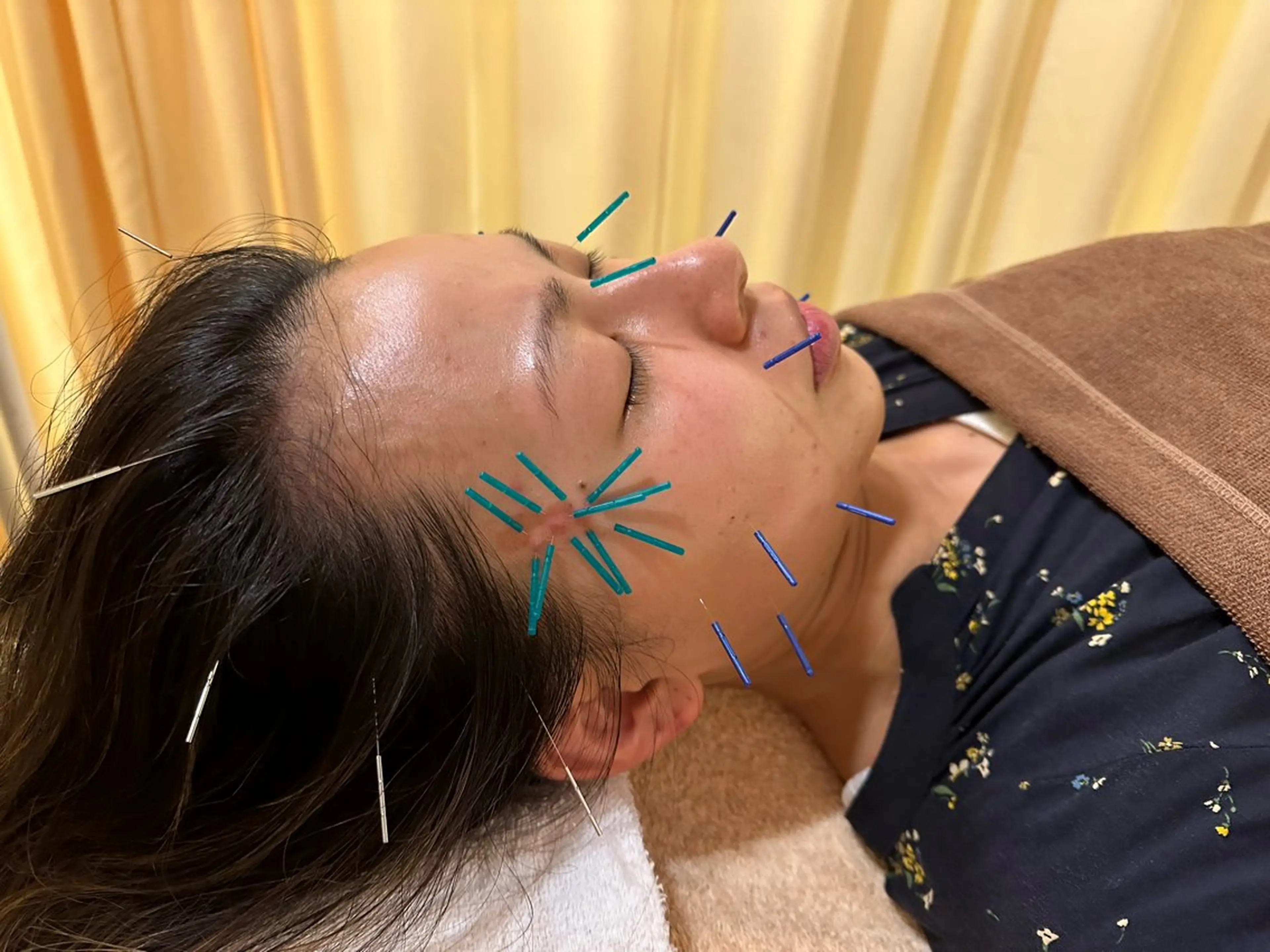 その他 鍼灸サロン BBB3のその他イメージ