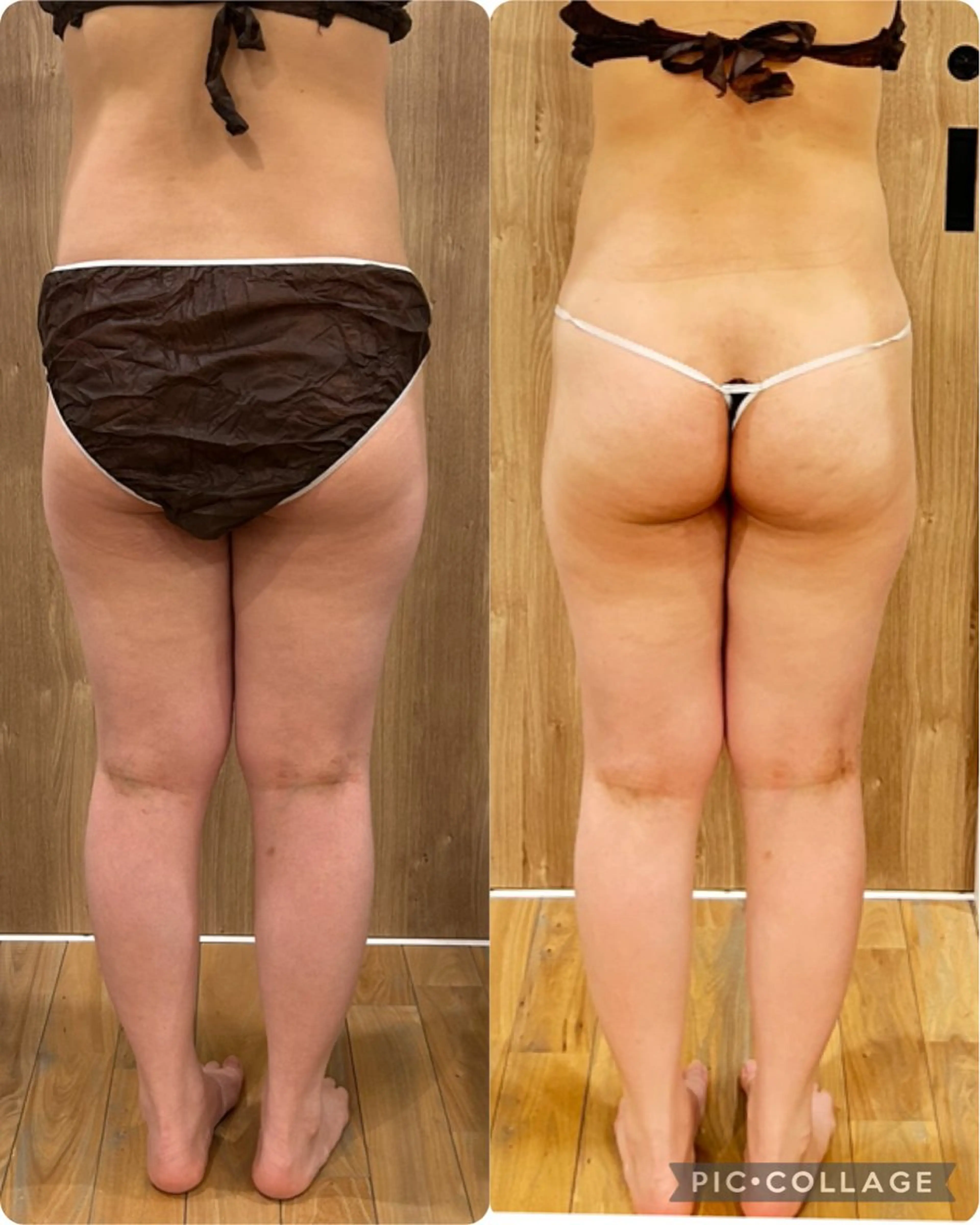 エステ indiba soleilのエステ・リラクイメージ