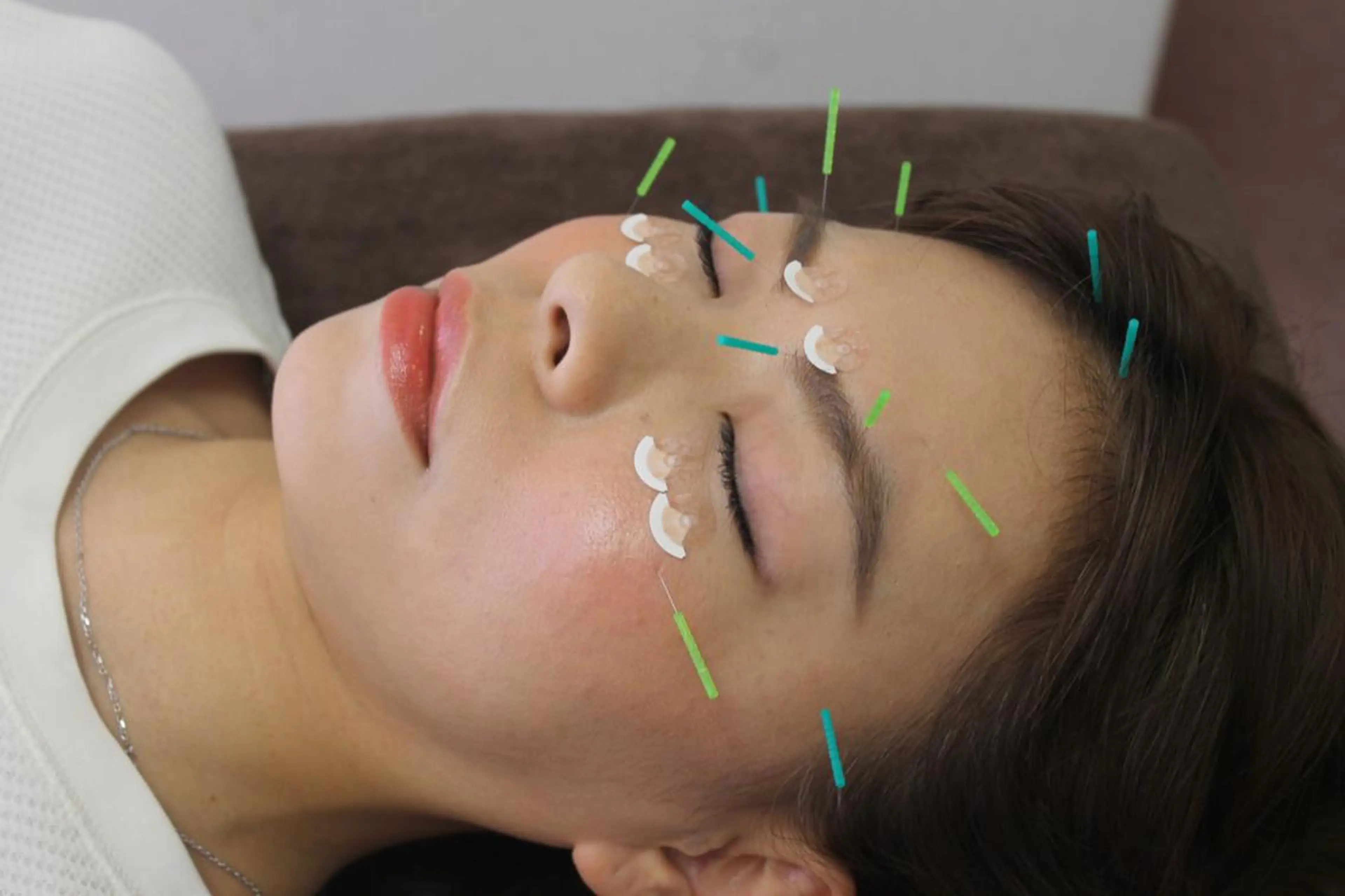 エステ リラク 同心整骨院 美容鍼・整体・小顔のエステ・リラクイメージ