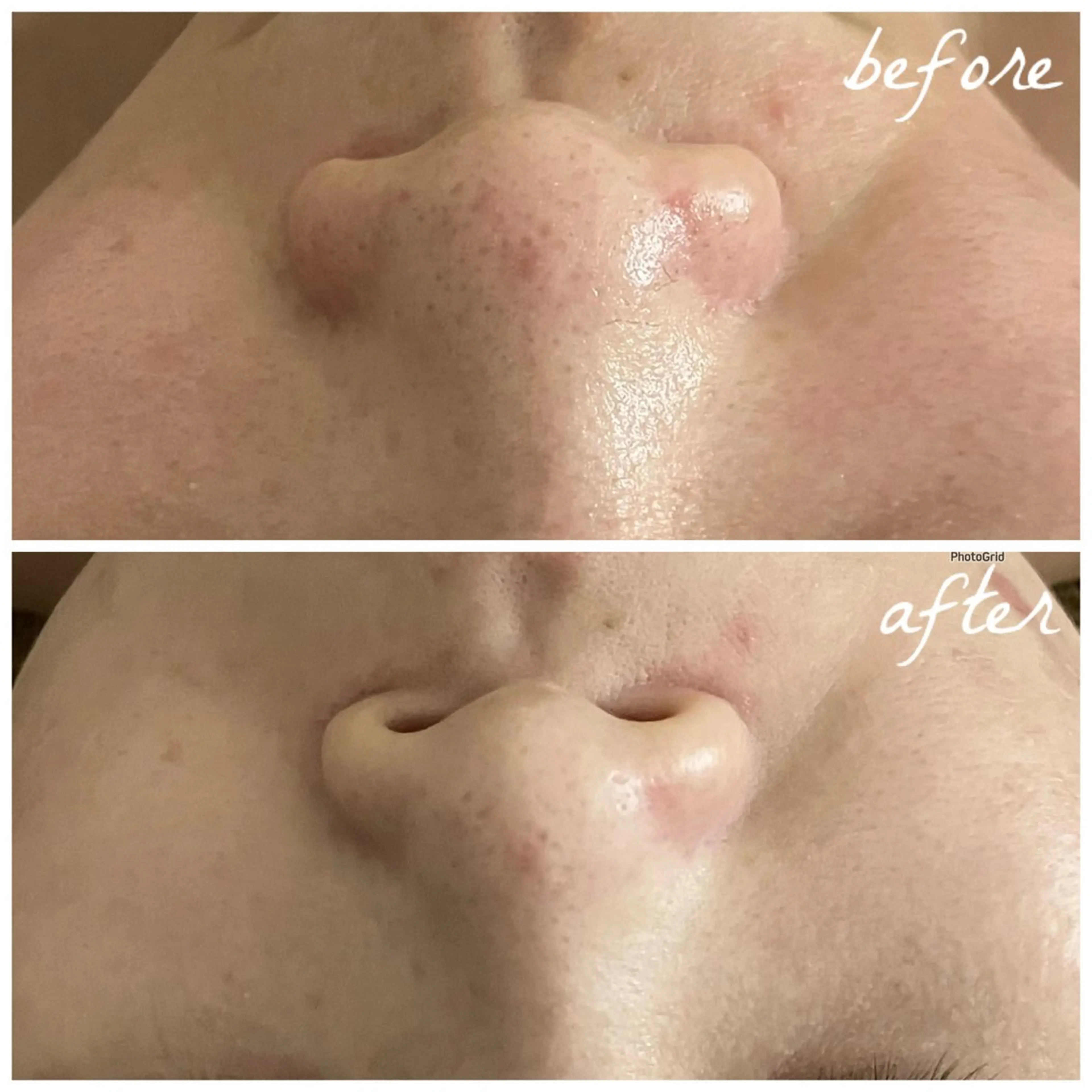 メンズ エステ メナード岐阜茜部 杉浦のエステ・リラクイメージ