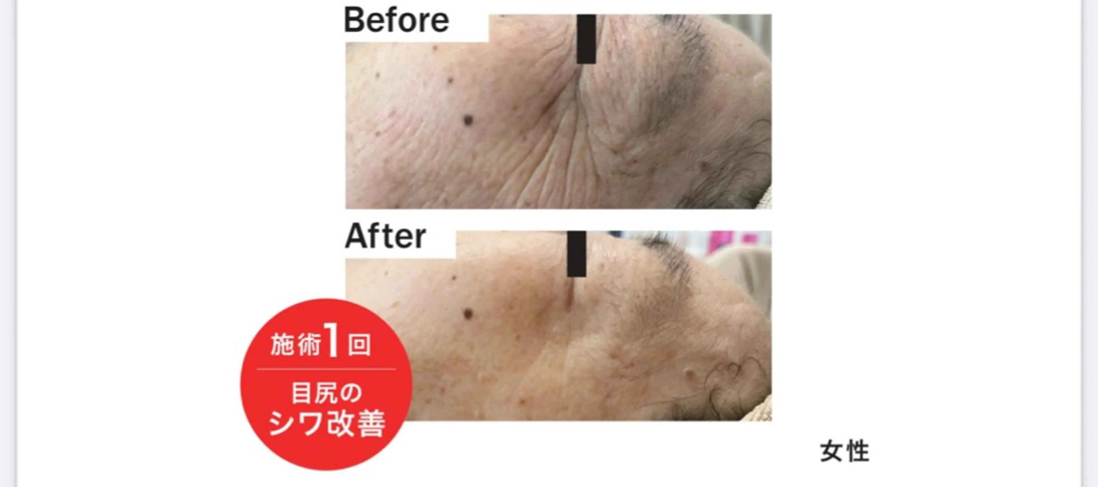 その他 LUMINAルミナ 【肌管理サロン】のその他イメージ