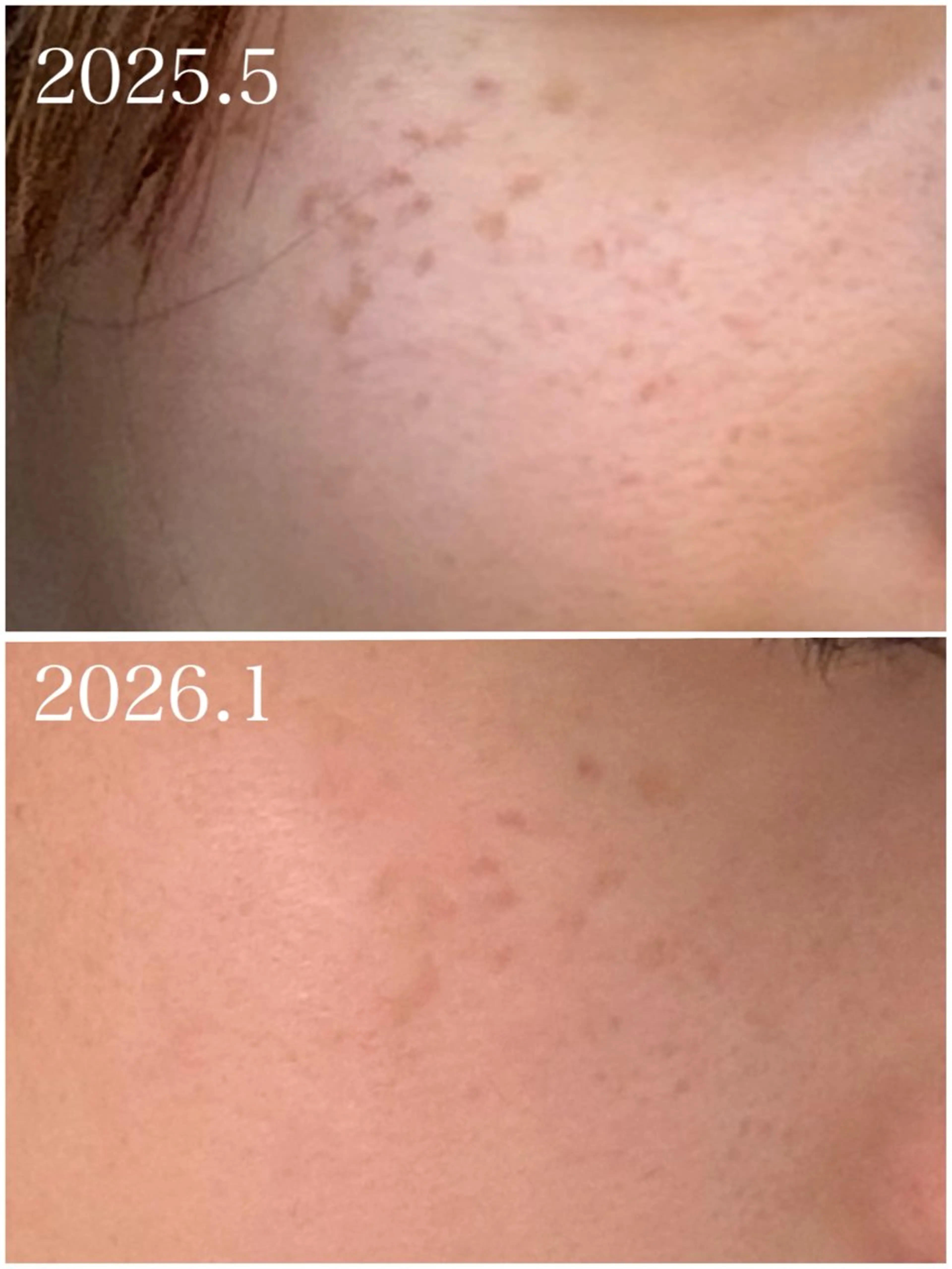 エステ 武藤 那月のエステ・リラクイメージ