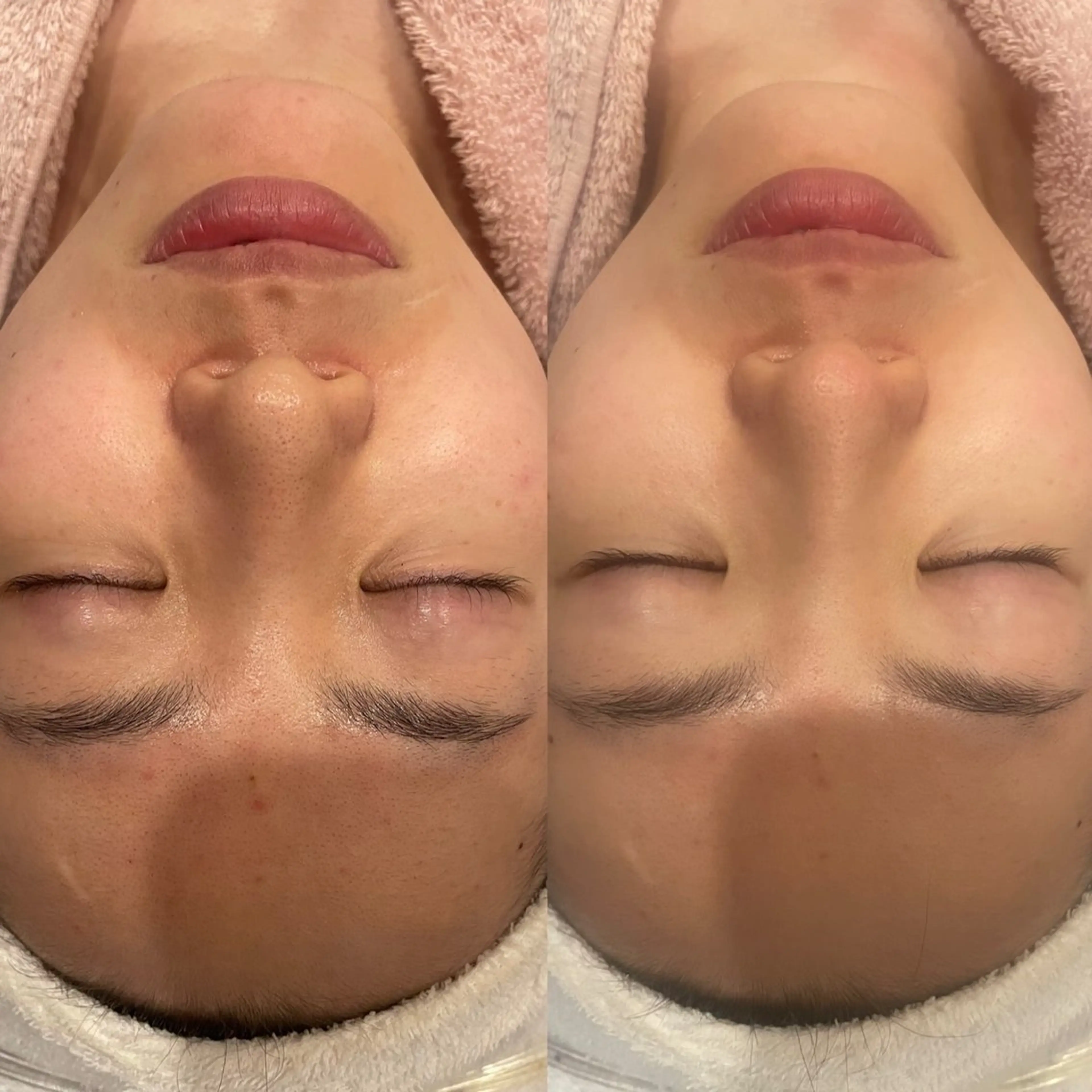 丸の内ヒルズ 鈴木麻瑚のエステ・リラクイメージ