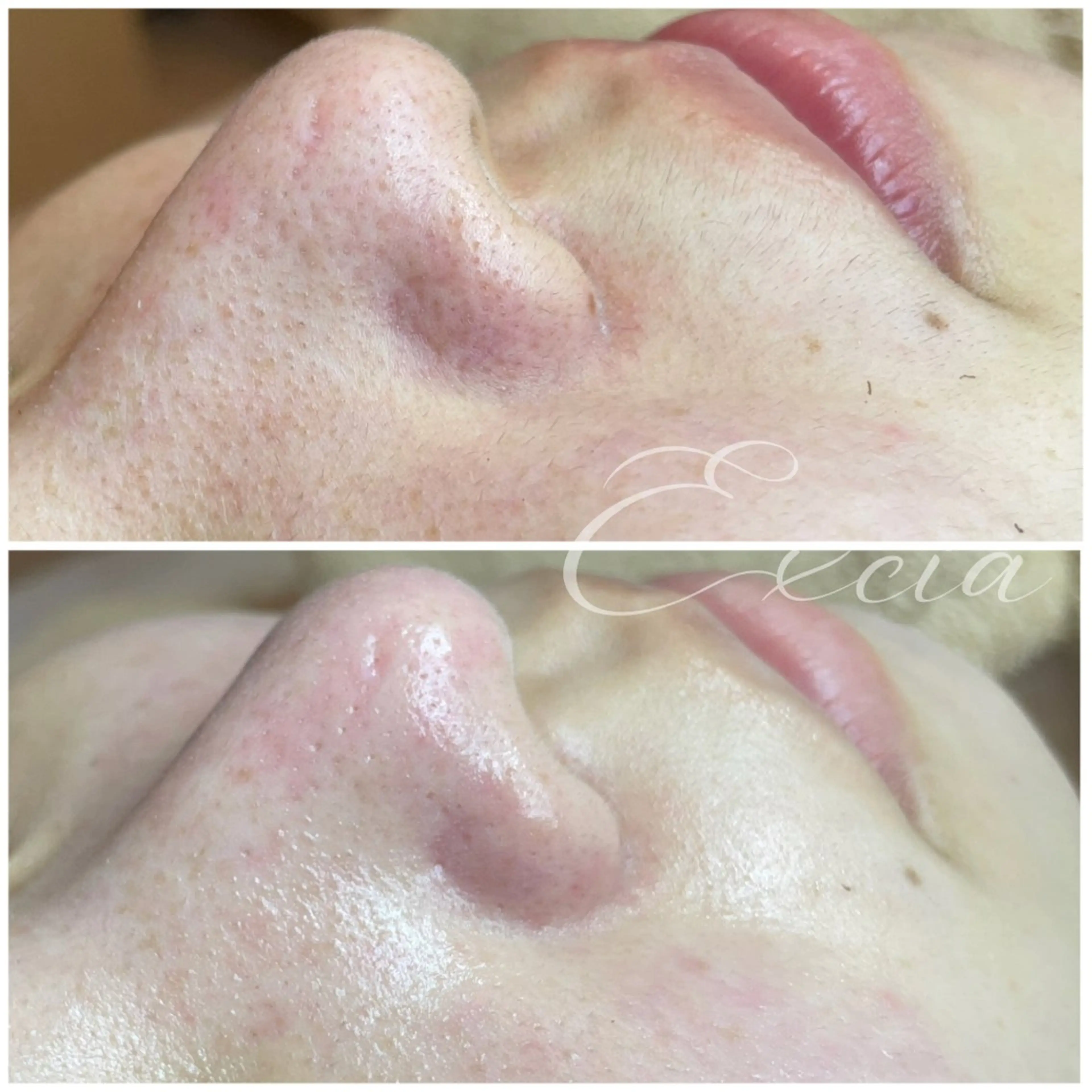 EXCIA所属・EXCIA （エクシア）のエステ・リラクイメージ