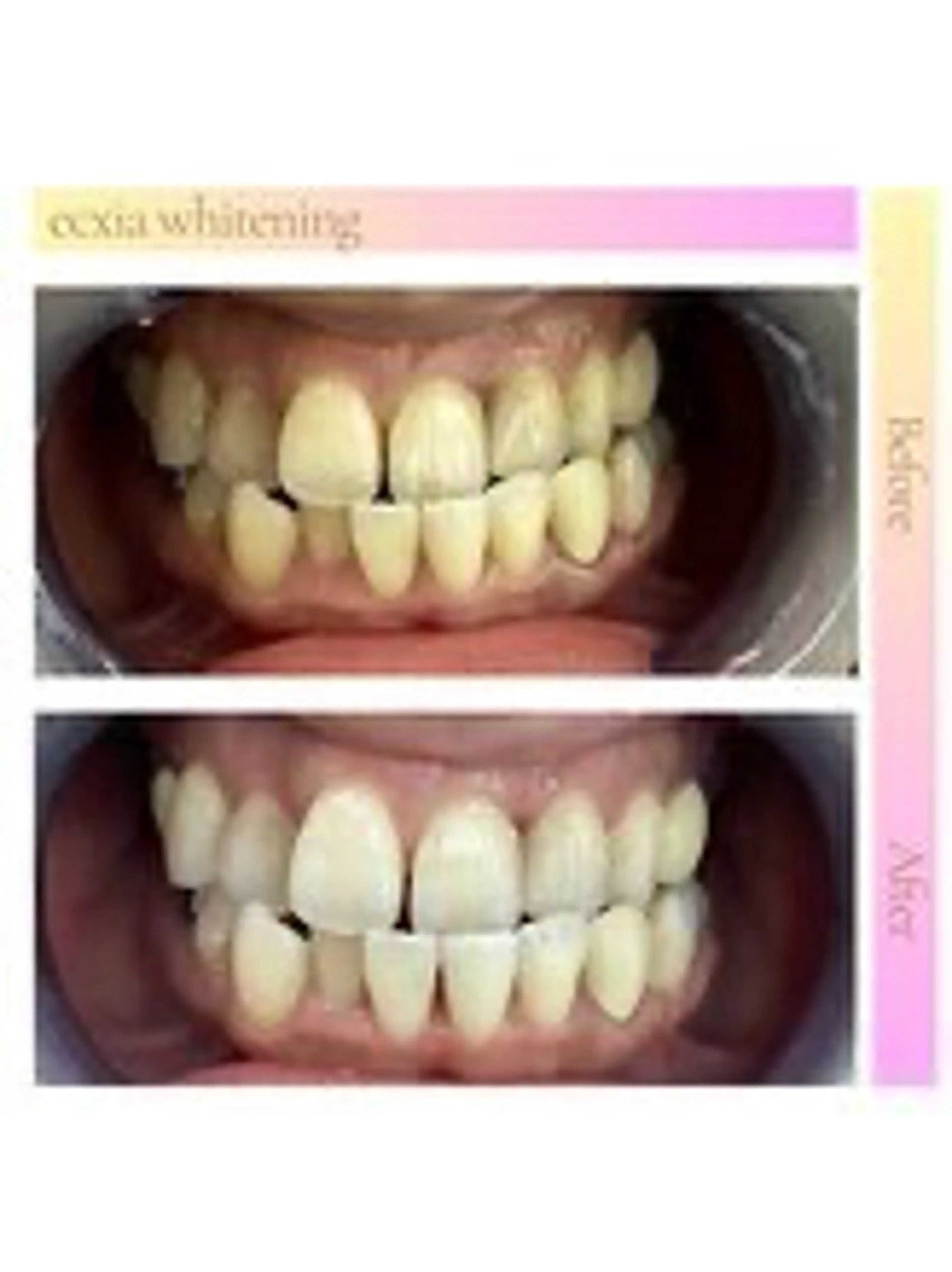 セルフホワイトニング エクシア西宮北口店所属・セルフホワイトニング エクシア西宮北口店のその他イメージ