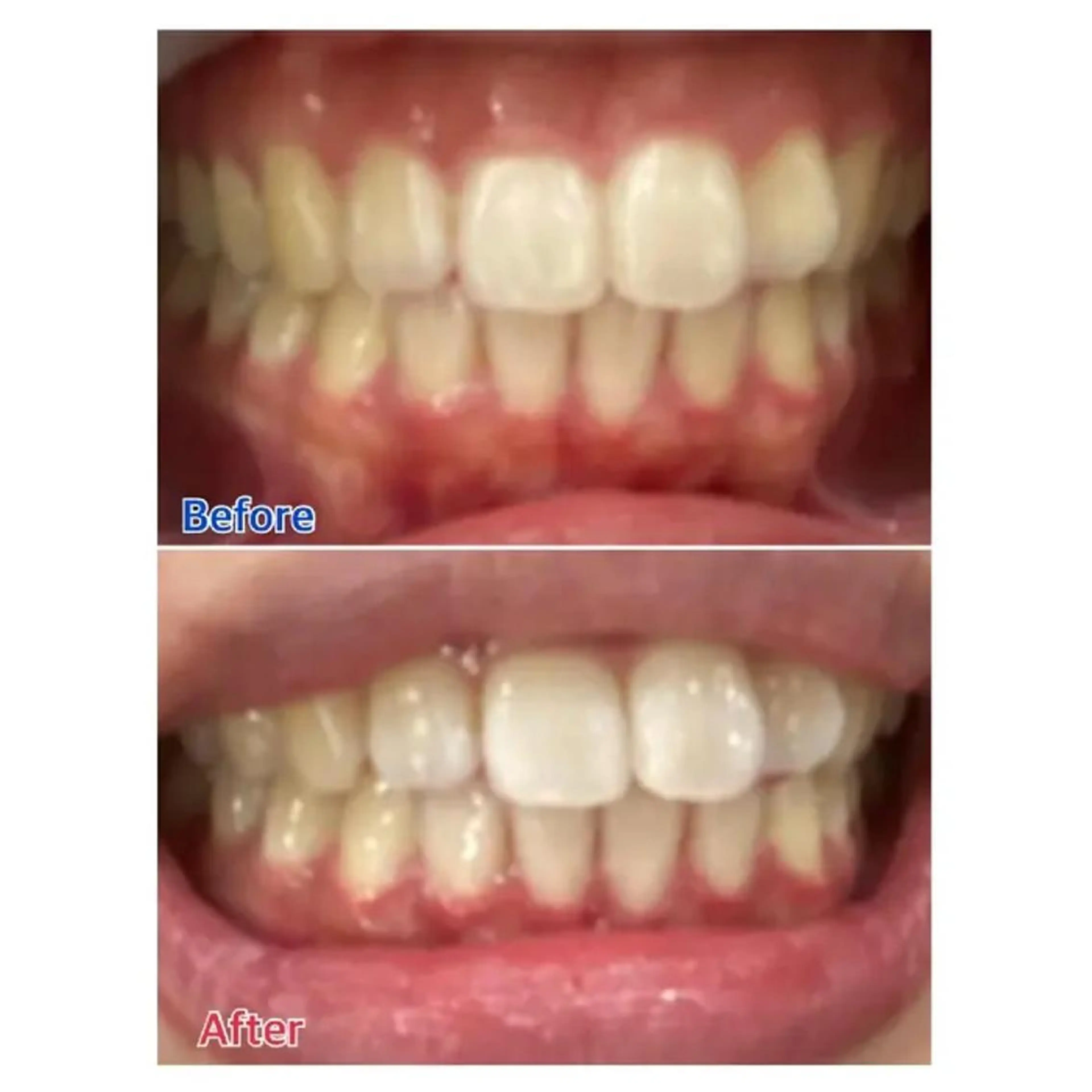 M渋谷 ホワイトニングのその他イメージ