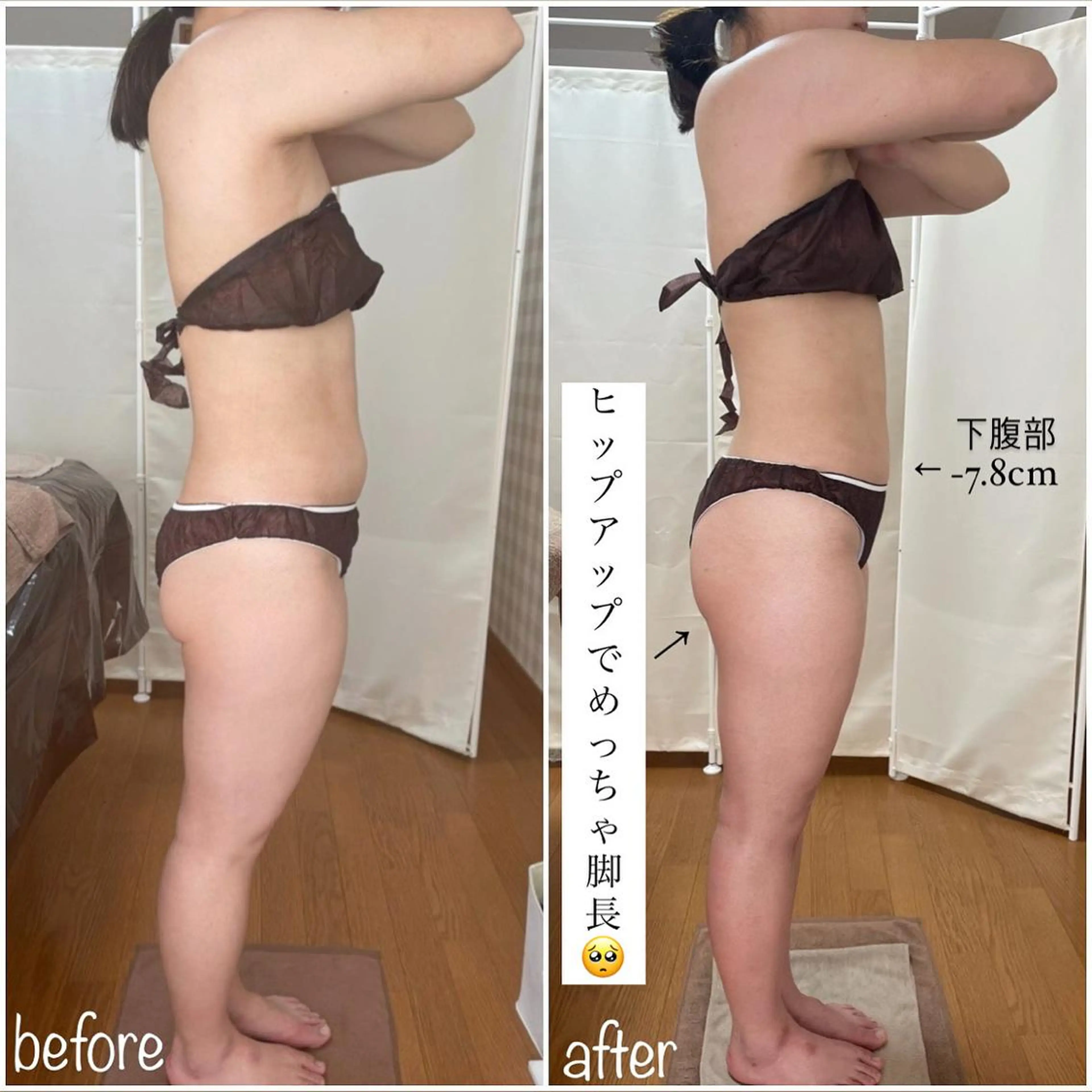 《本気痩せ×疲労改善 》  BILOOPのエステ・リラクイメージ