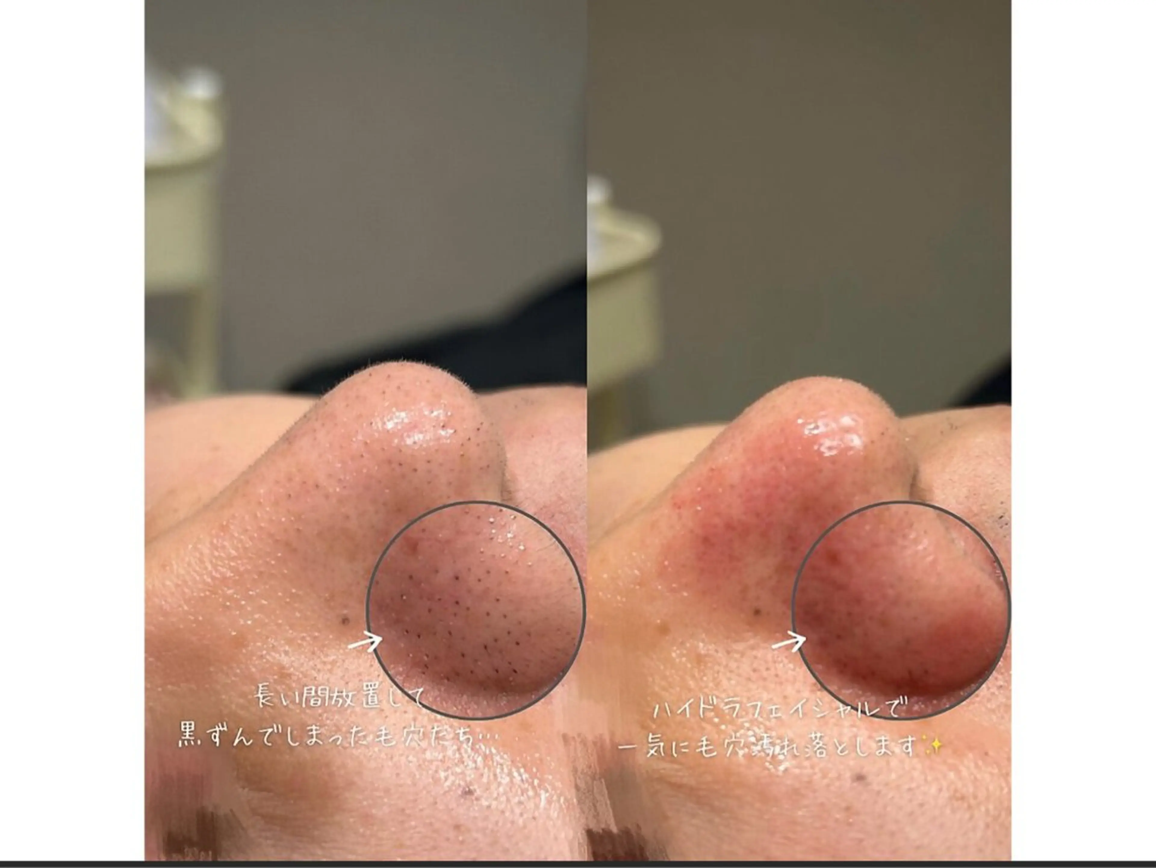 miyu 🩵のエステ・リラクイメージ