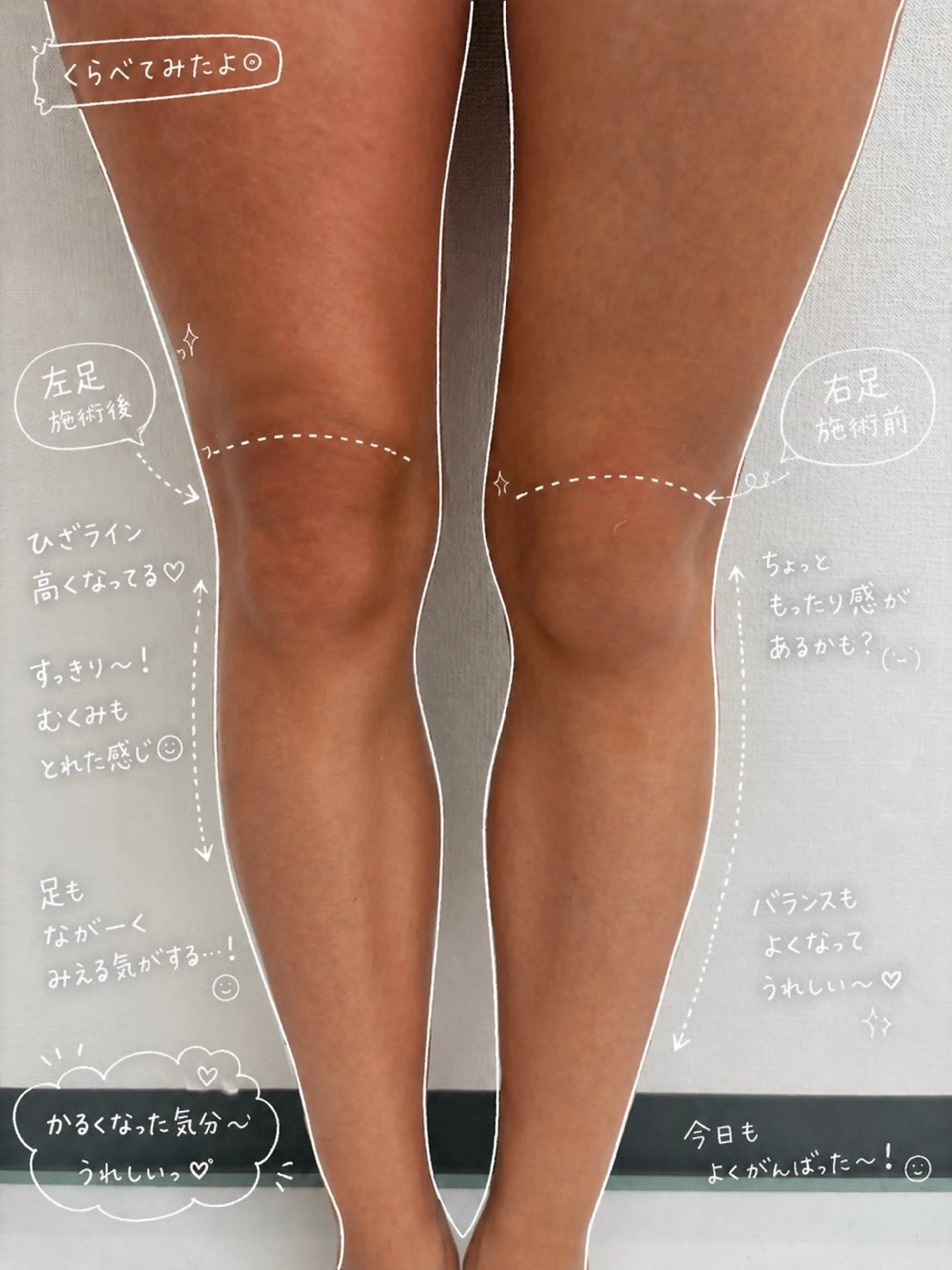 エルモサ痩身脱毛 西八王子店のエステ・リラクイメージ