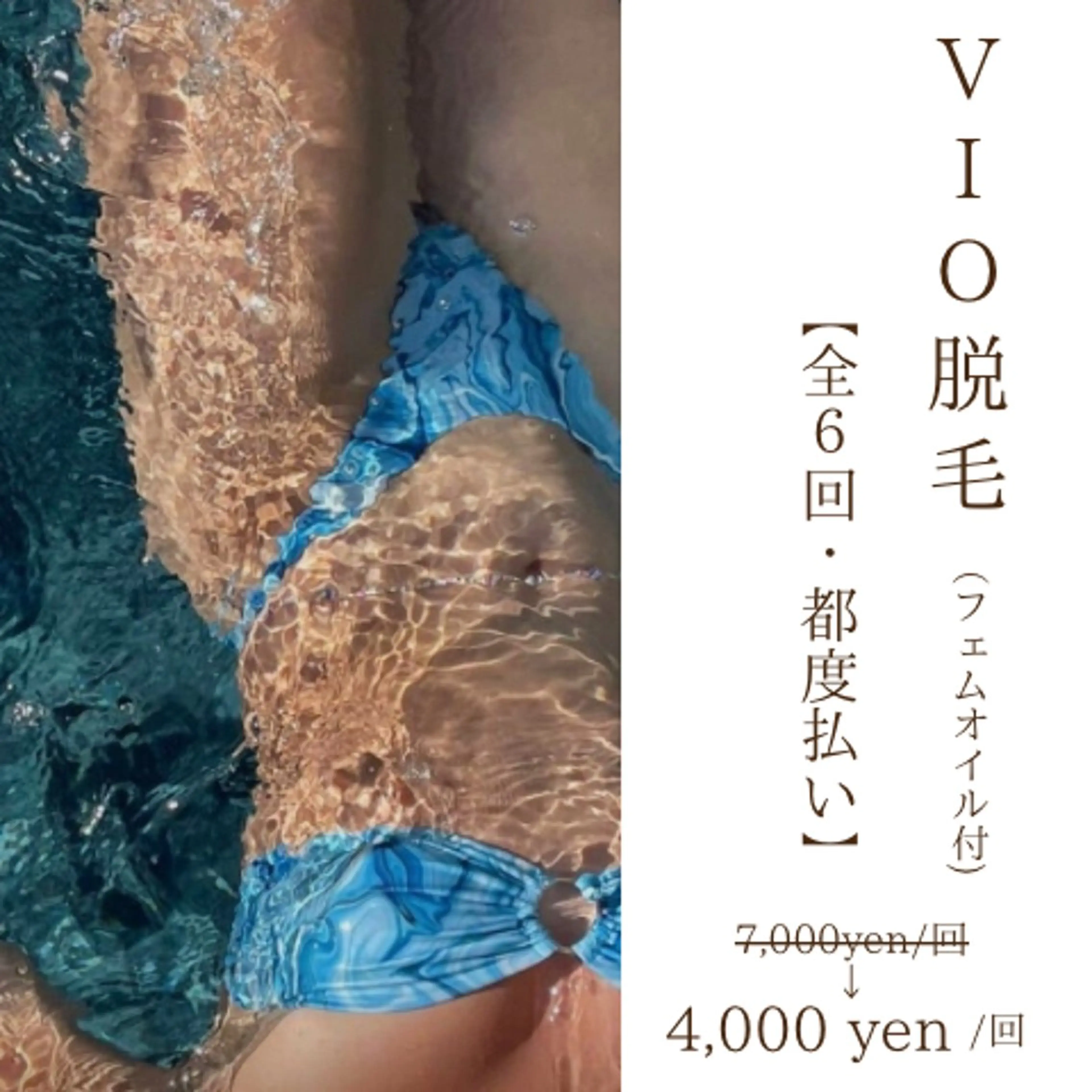 快適な夏に向けて🏖☀️サクッとVIO脱毛の写真