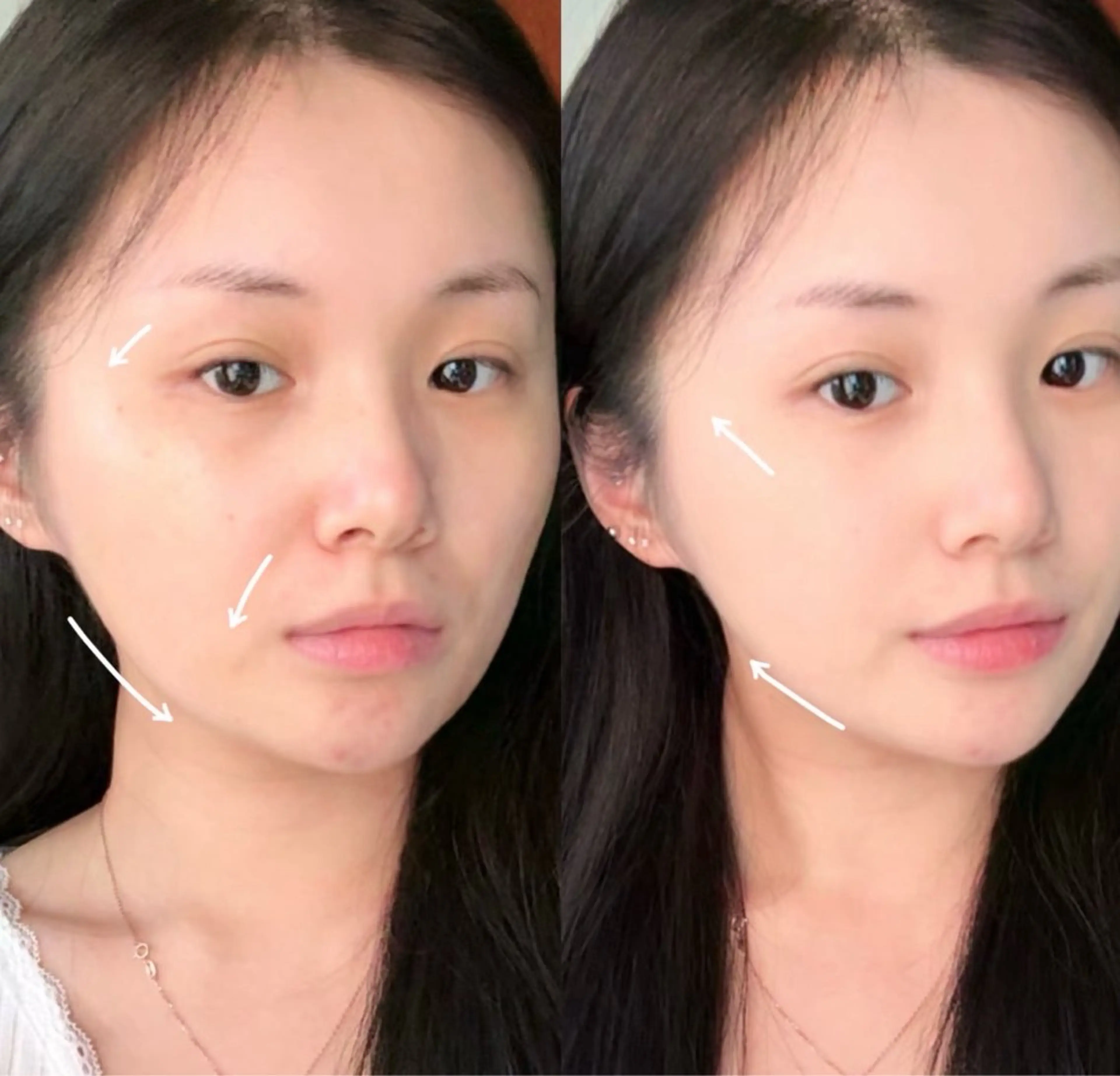 エステ aliaハイフ&水光ジェットサロン所属・aliaハーブ水光店 エステティシャン募集のエステ・リラクイメージ