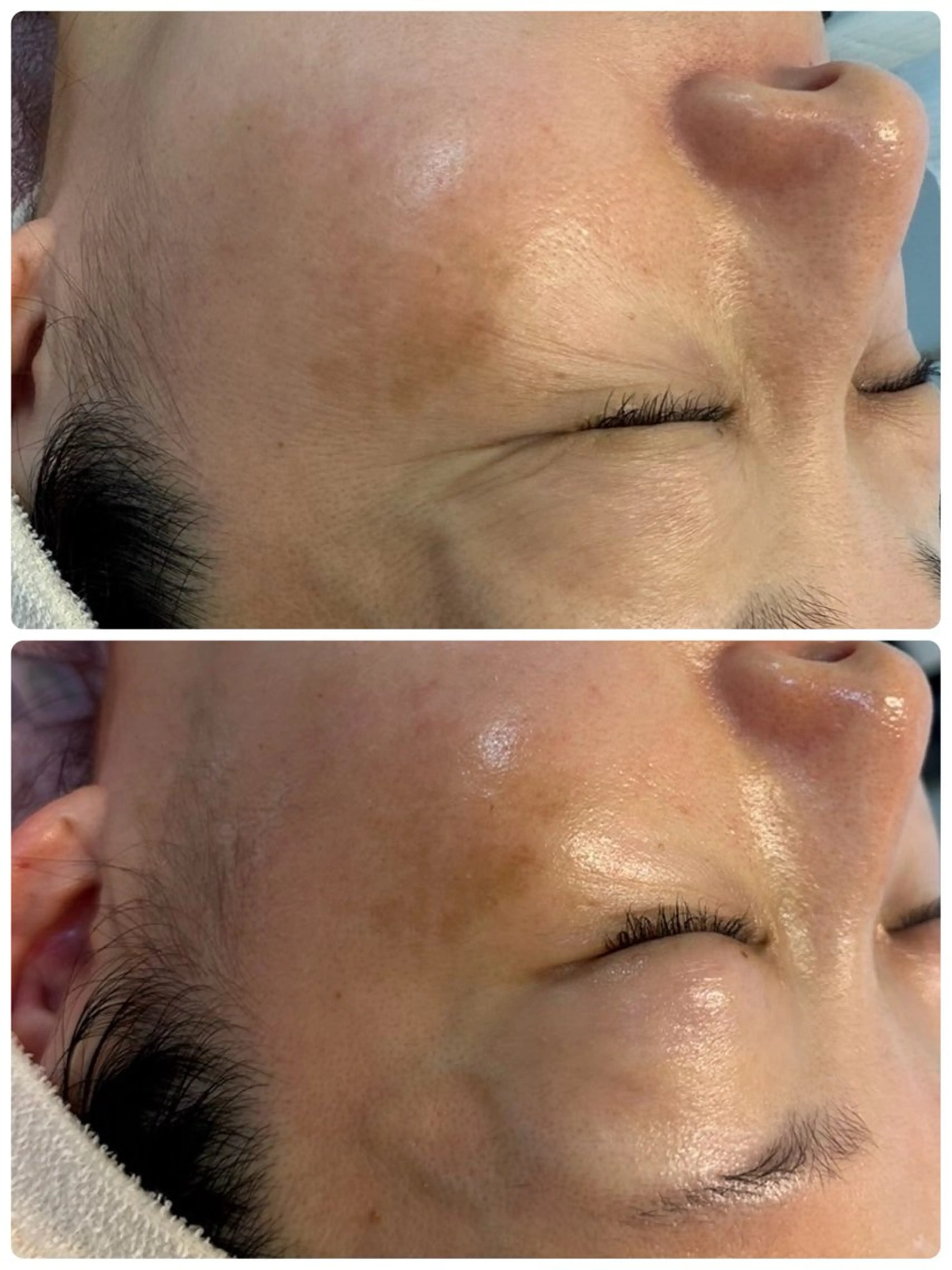 肌診断➕肌別フェイシャルエステ　ミニモ学割の写真