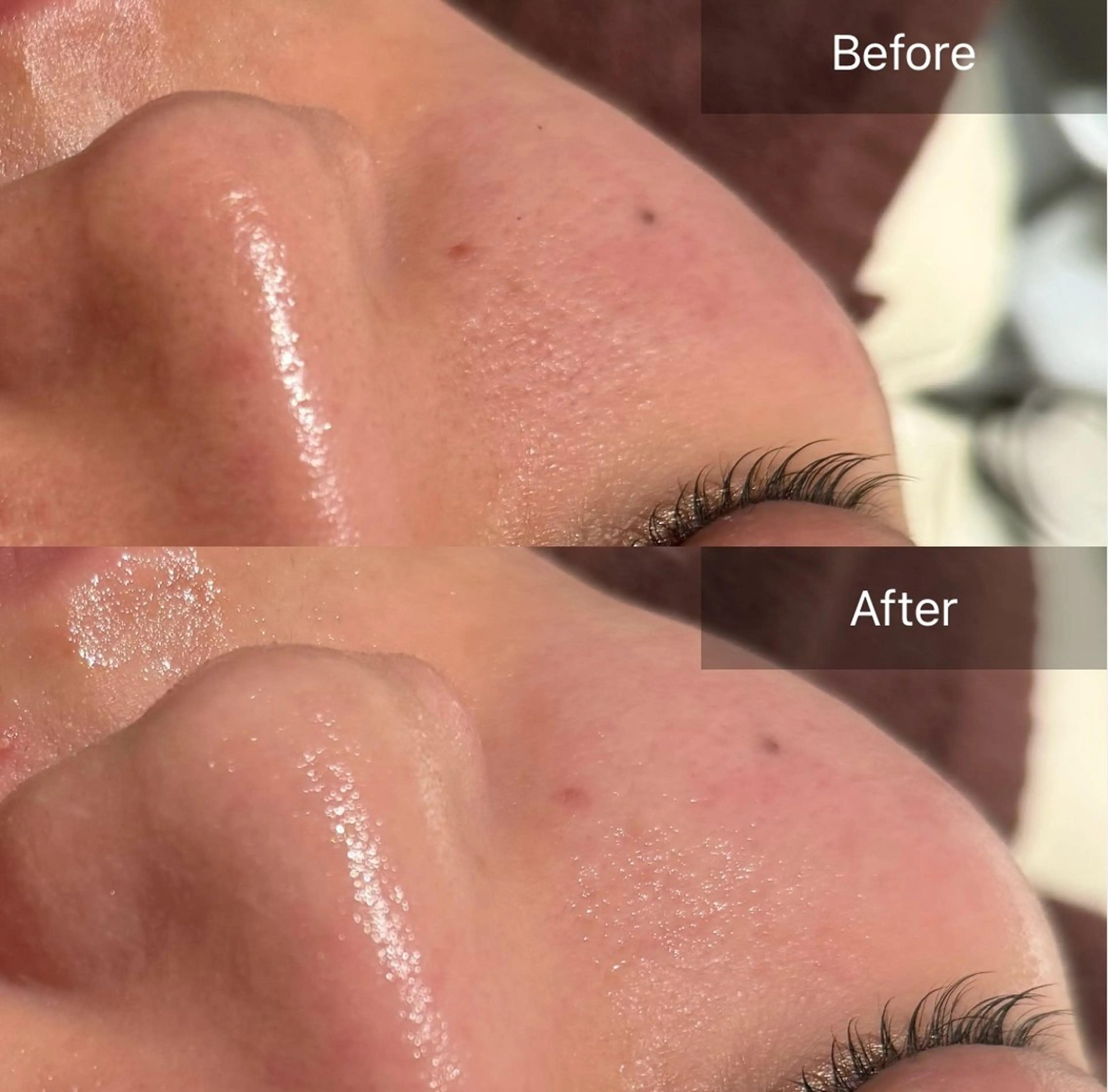 その他 for woman所属・森 美優のエステ・リラクイメージ