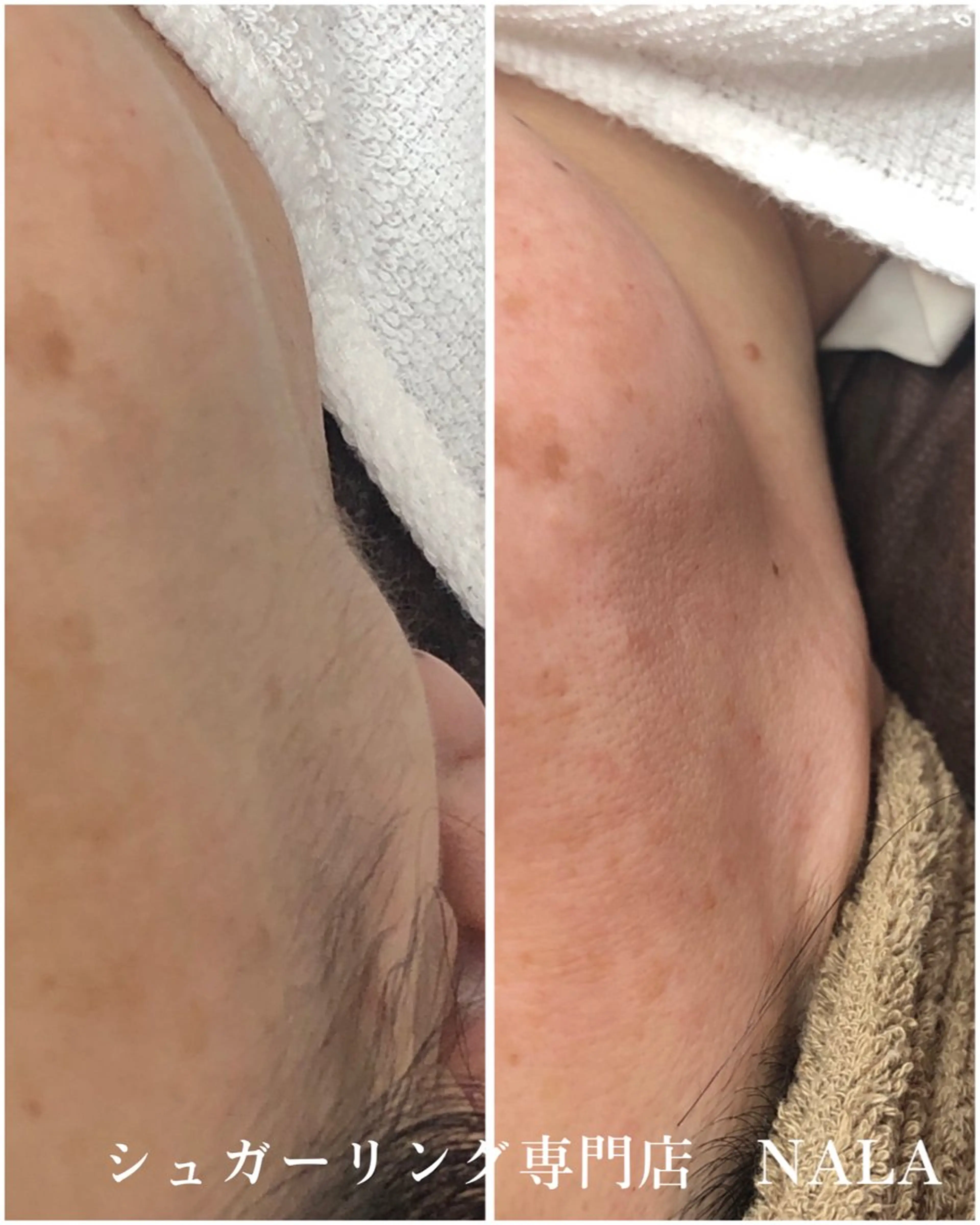 シュガーリング 専門店『NALA』のエステ・リラクイメージ