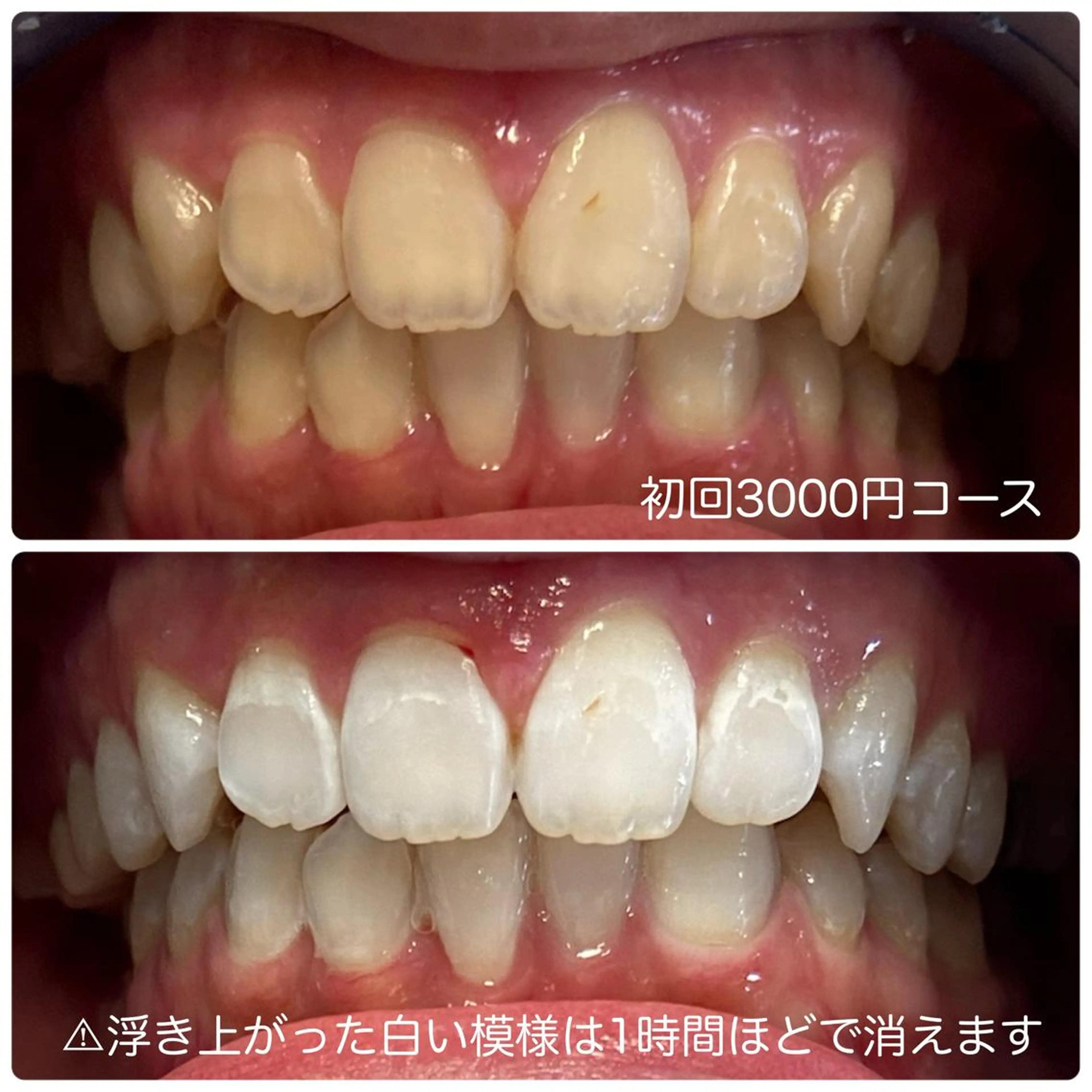 ホワイトニングルーム 川崎店所属・ホワイトニング ルーム 川崎店のその他イメージ