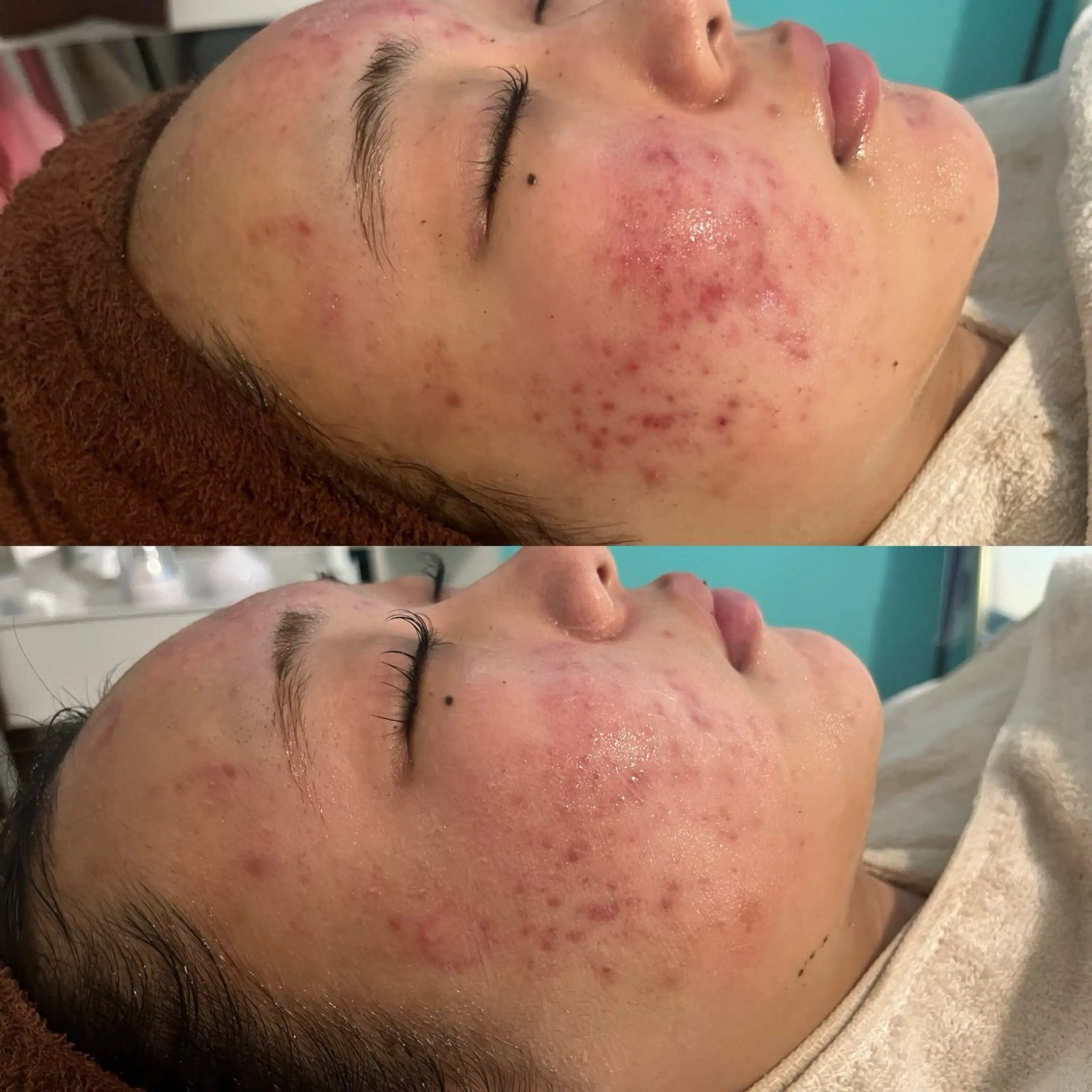 エステ 韓国肌管理 Belleのエステ・リラクイメージ