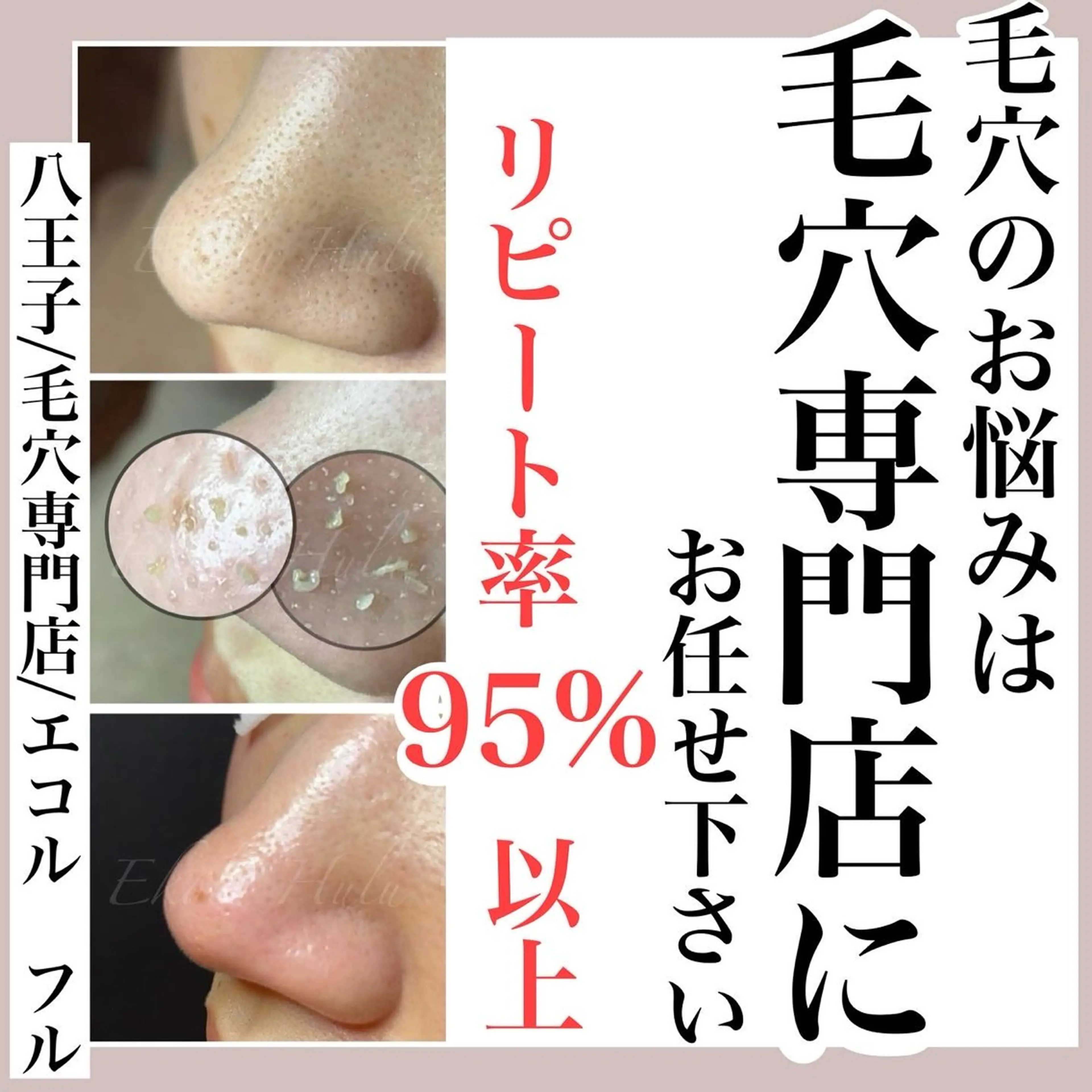 【初回限定】極上フェイシャルの写真