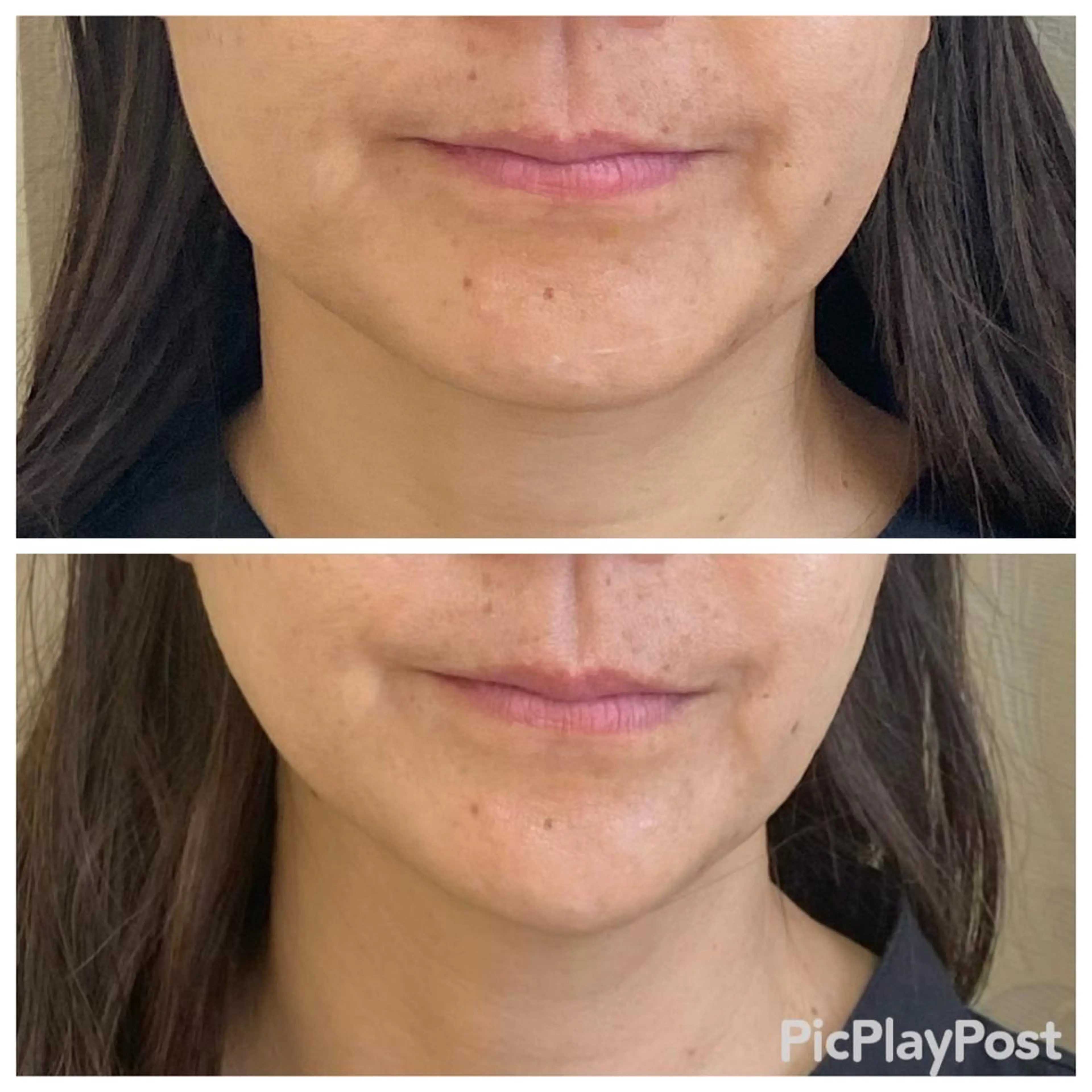 Ailes トータルビューティーのエステ・リラクイメージ