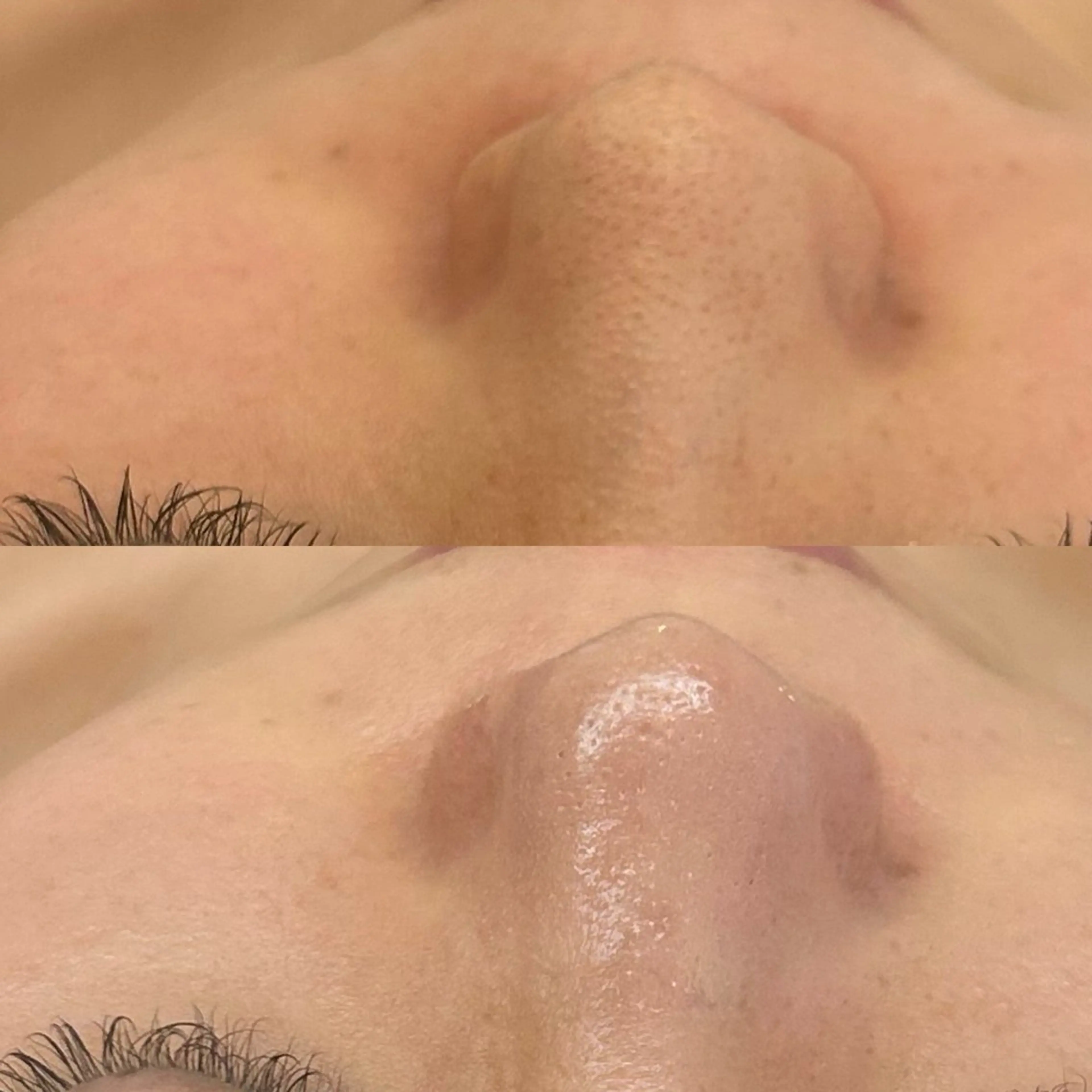 エステ 韓国🇰🇷価格 サロン_Nbibiの眉毛・アイブロウイメージ